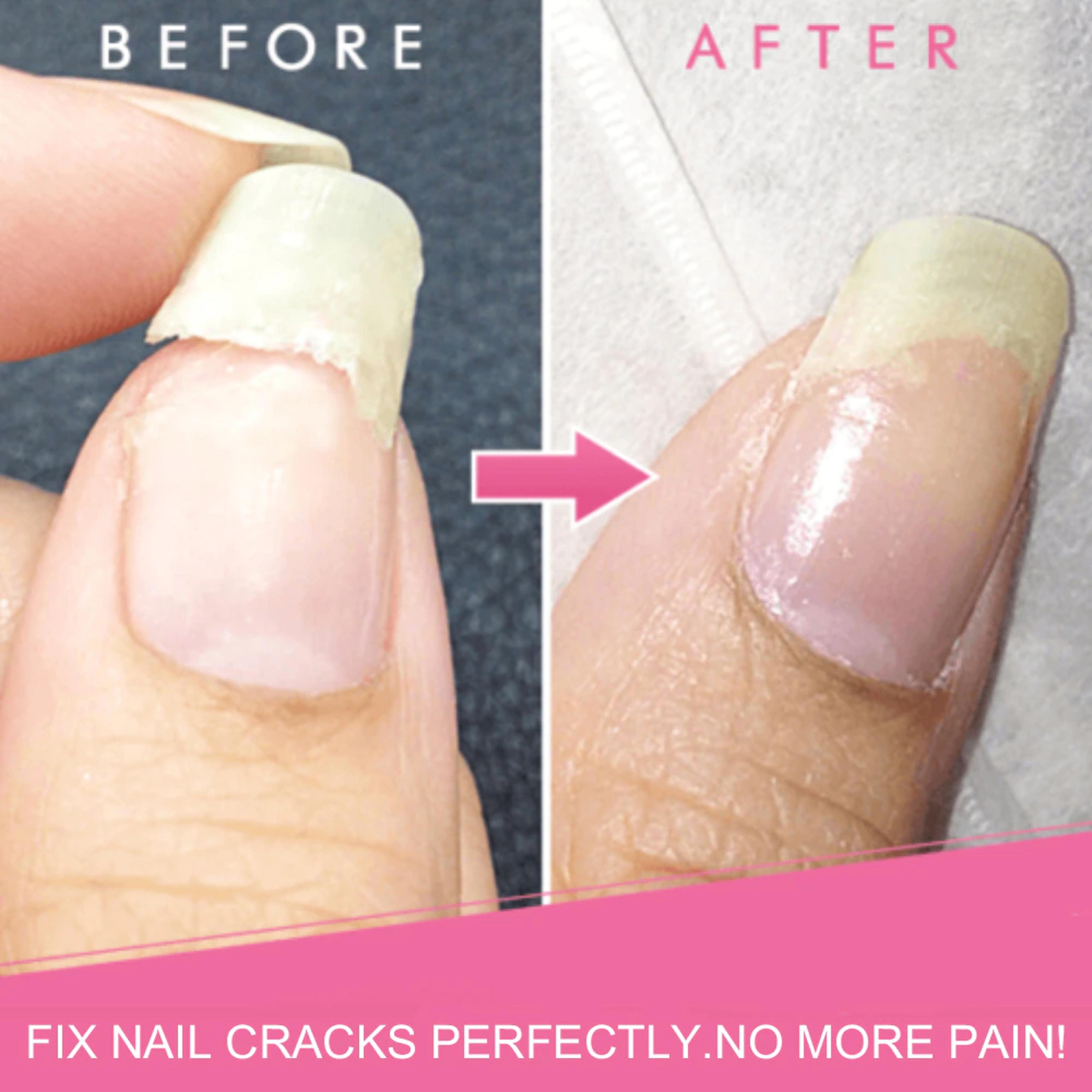 nailRescueinstantnailrepair5.png