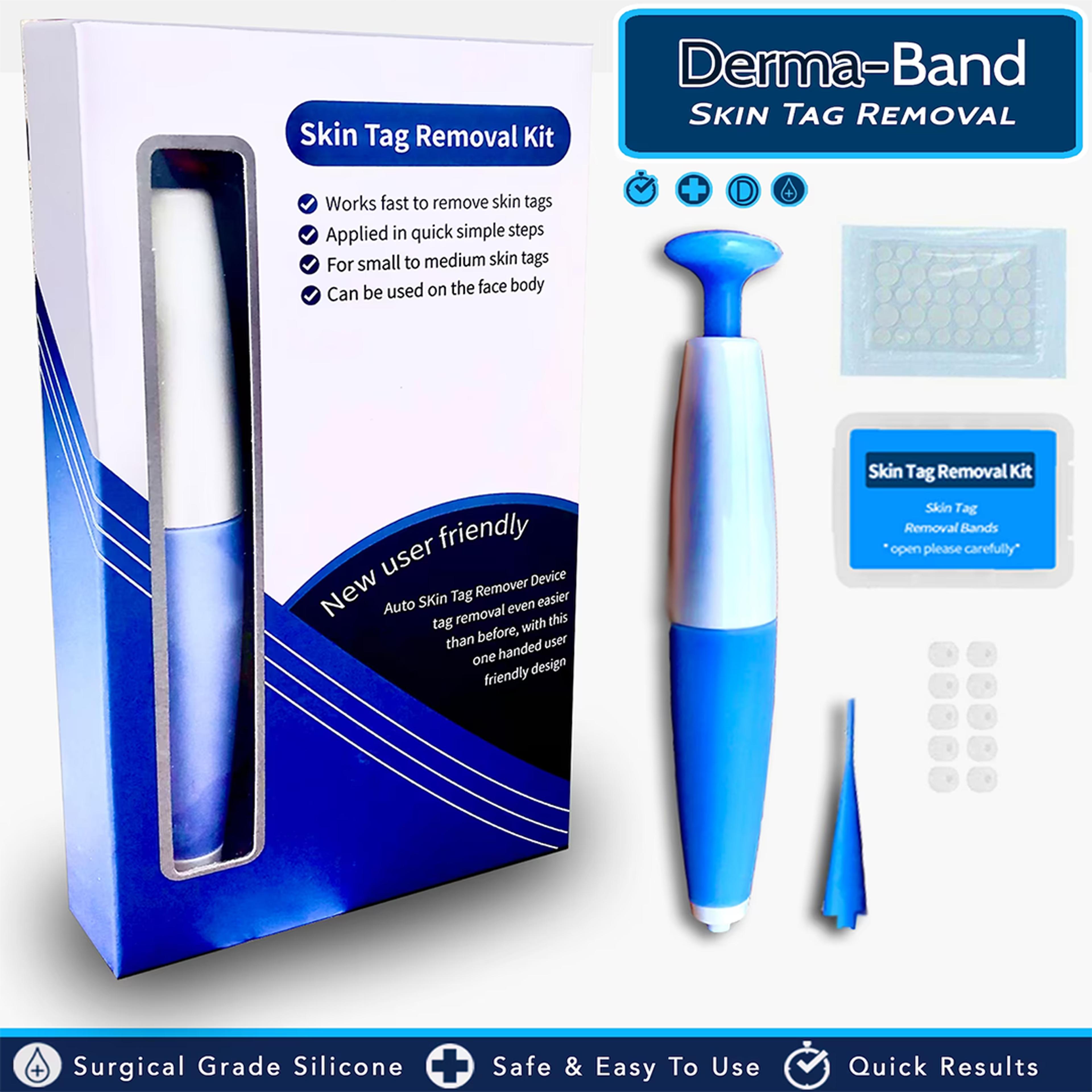 skintag remover