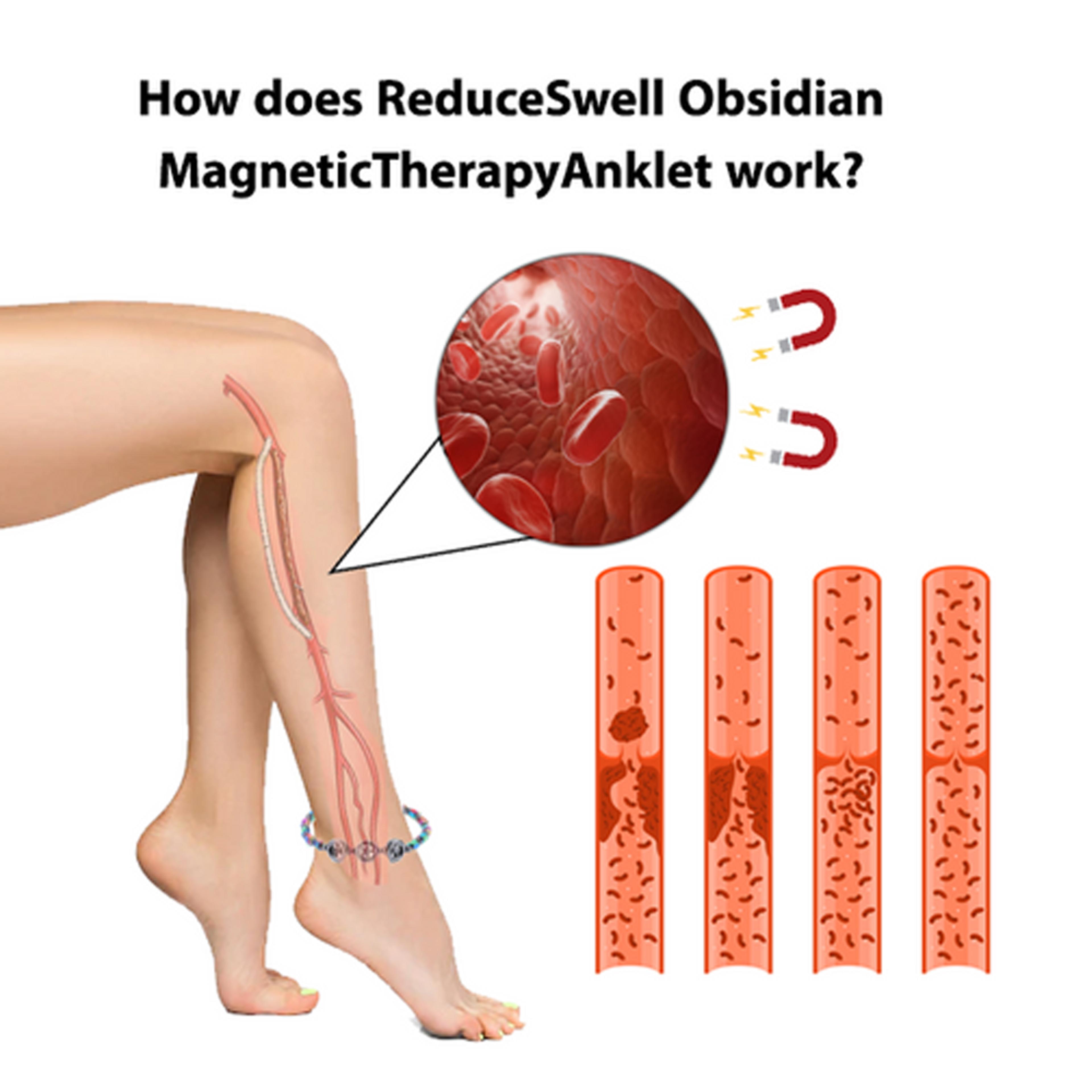 magneticankletforswelling5.png