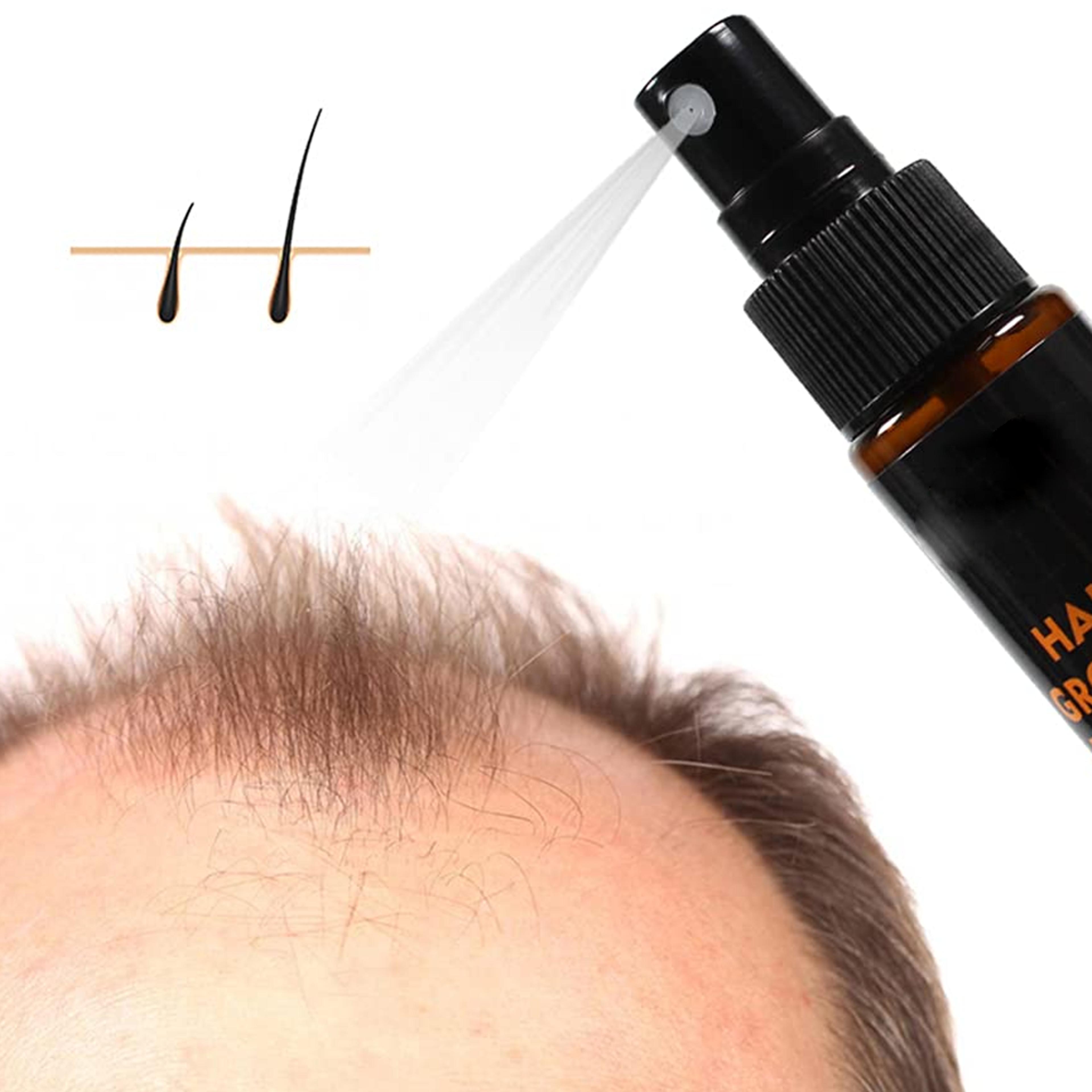 hairregrowthherbalessencespray3.png