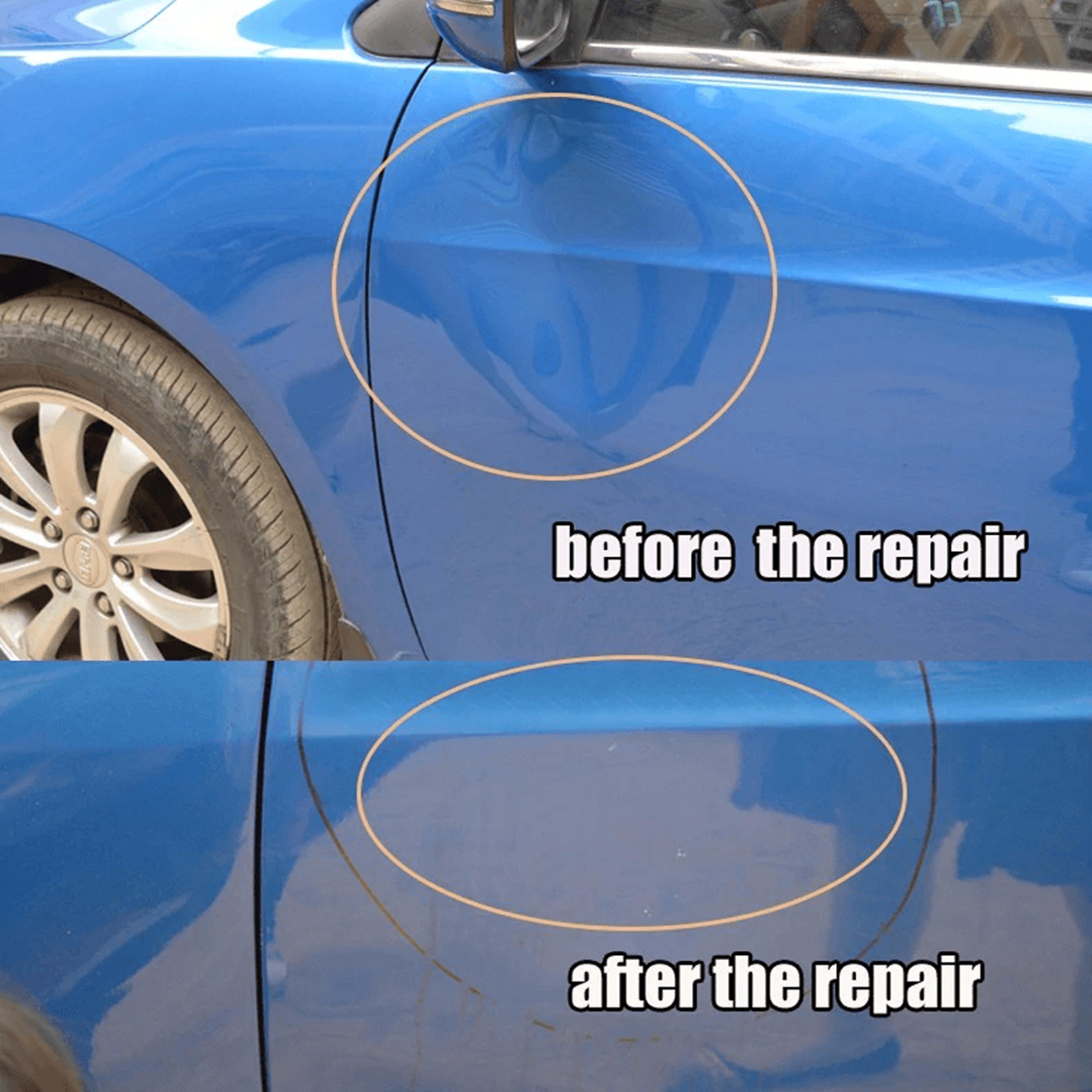 dentpullerbar4.png