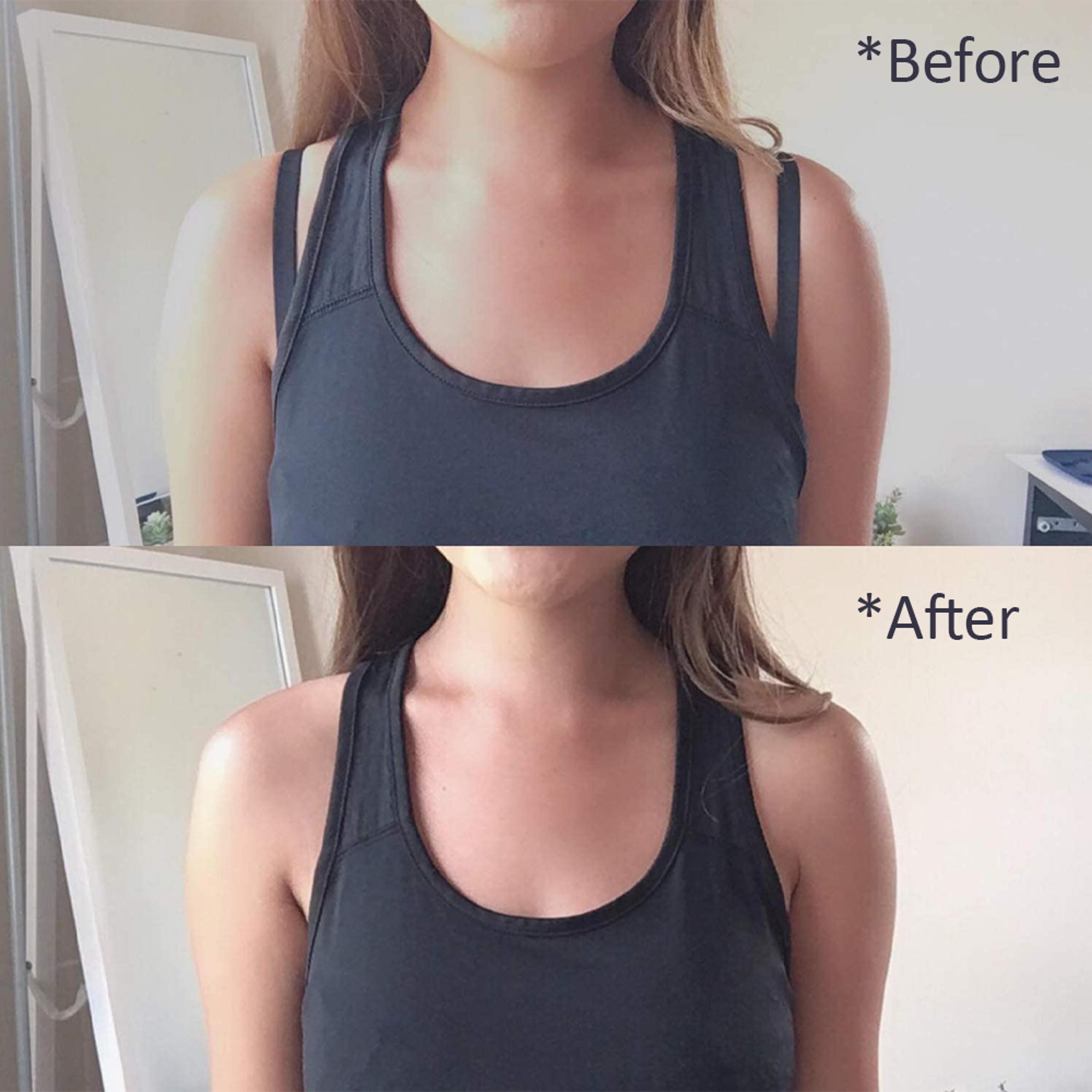 Bra strap accessories for dresses
