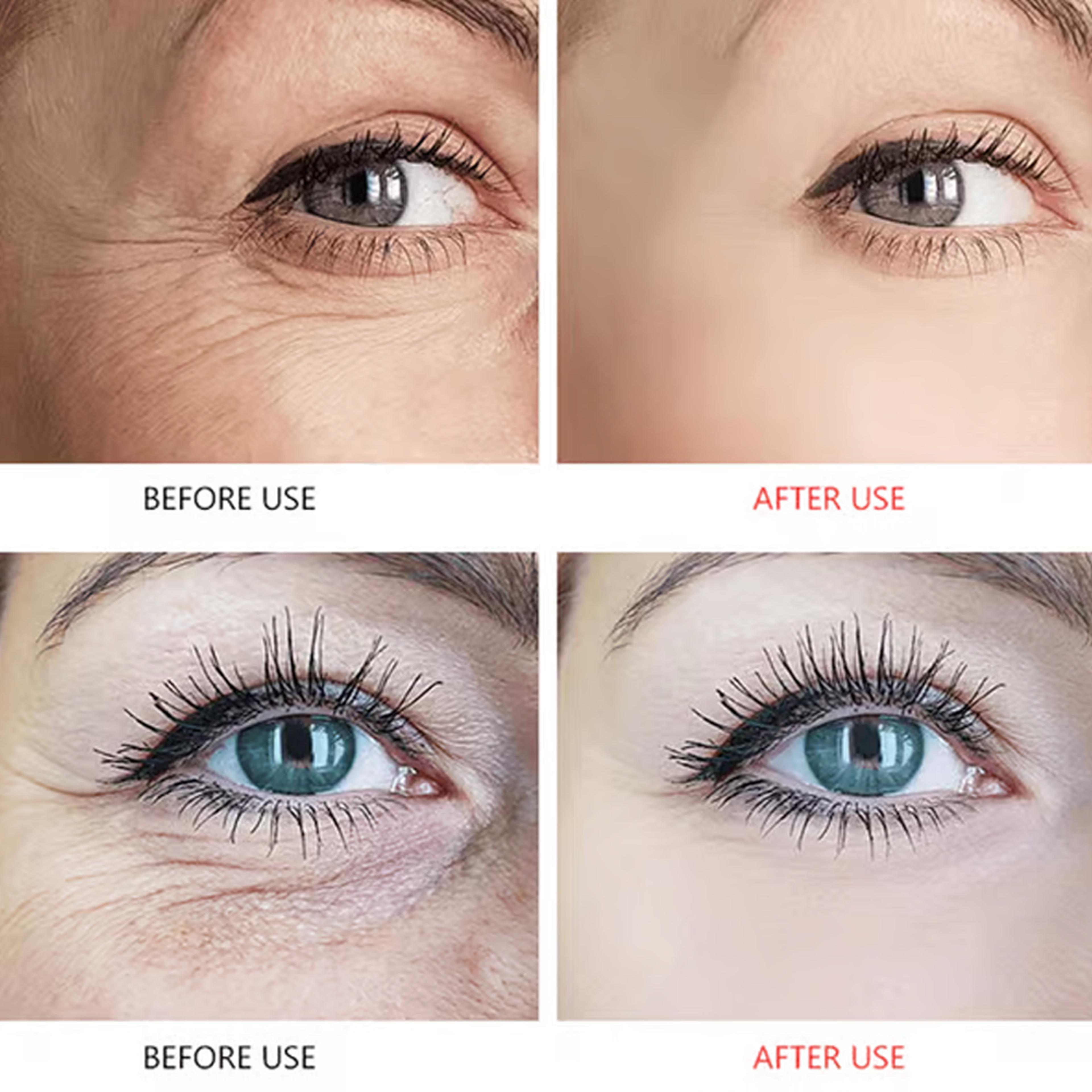 eyelinesmoisturizingeyepatches6.png