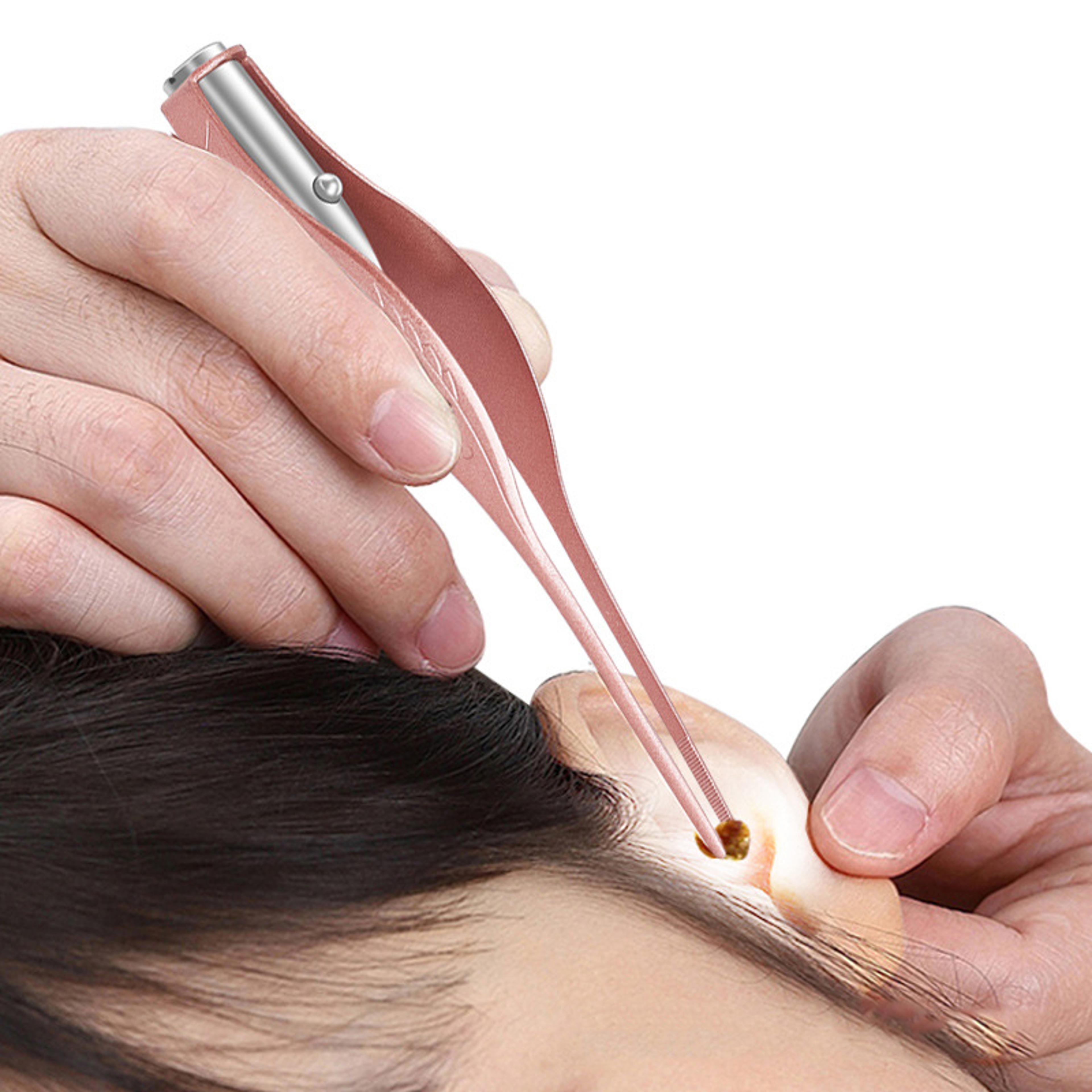 GlowView LED Ear Pick  Ear Cleaning Kit For Kids And Adults 0
