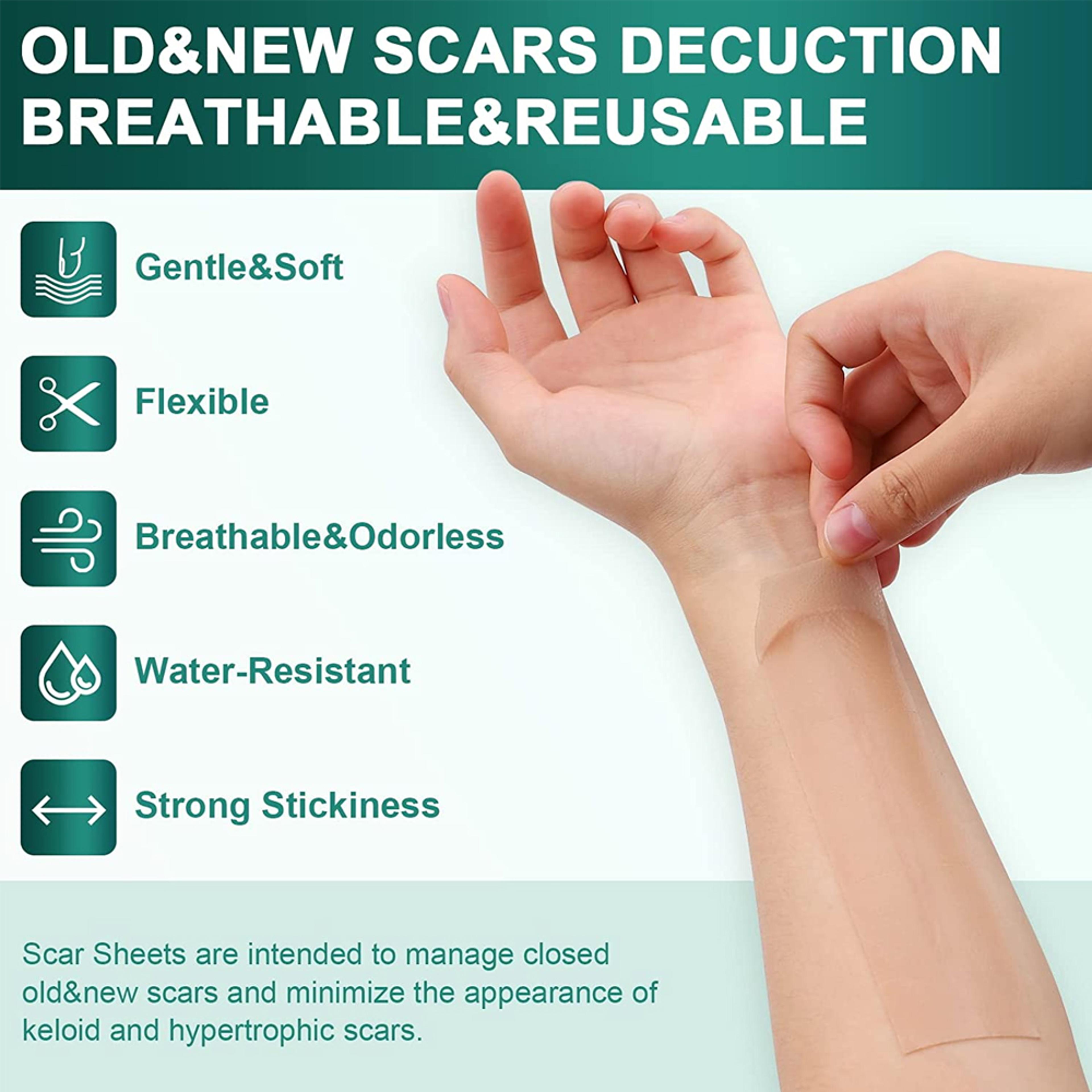Medical Grade Silicone Scar Sheets For Keloid Surgery  Burn Healing 2