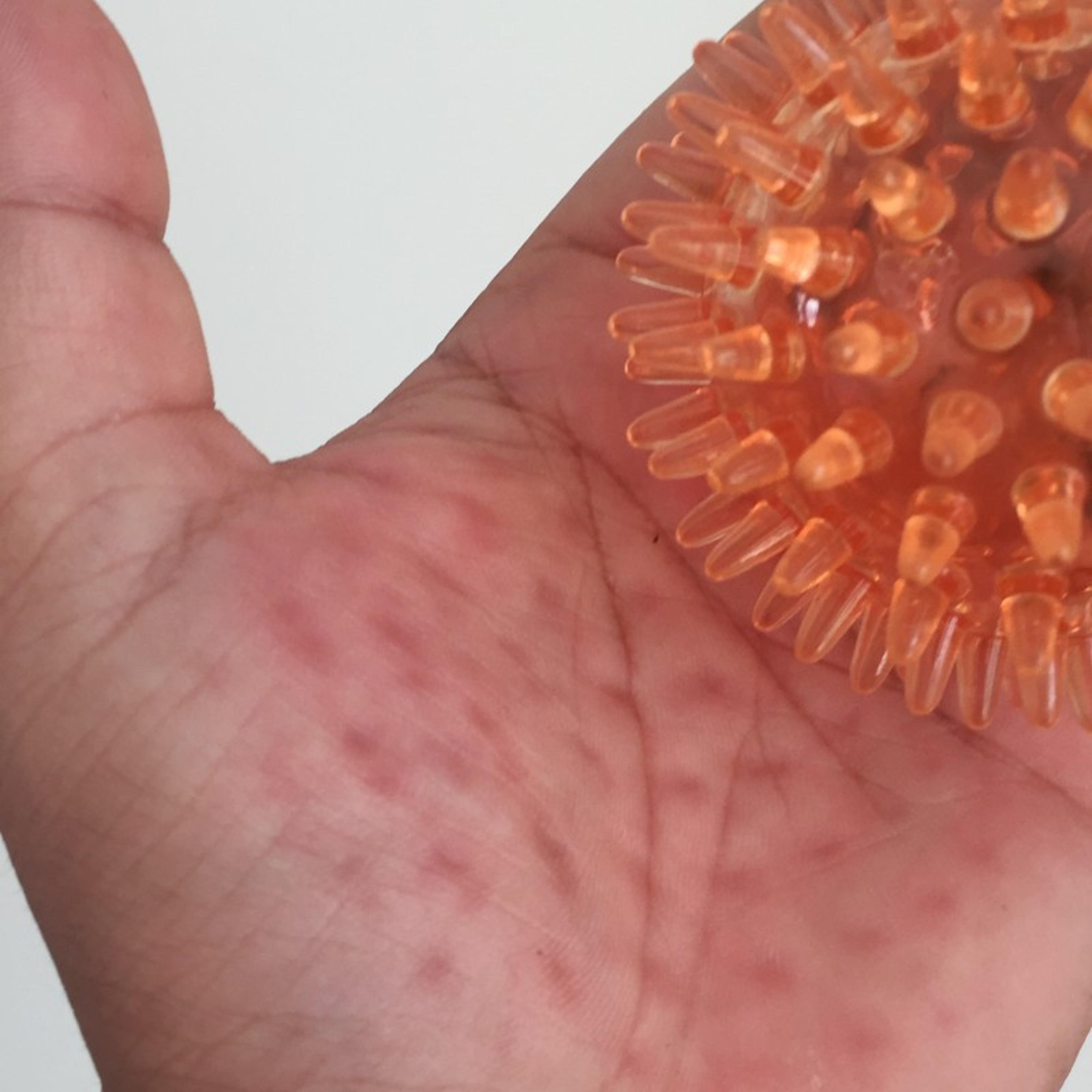 Spiky Hand Massage Ball For Stress Relief Exercise And Wrist Strength Recovery Transparent  Hollow  1