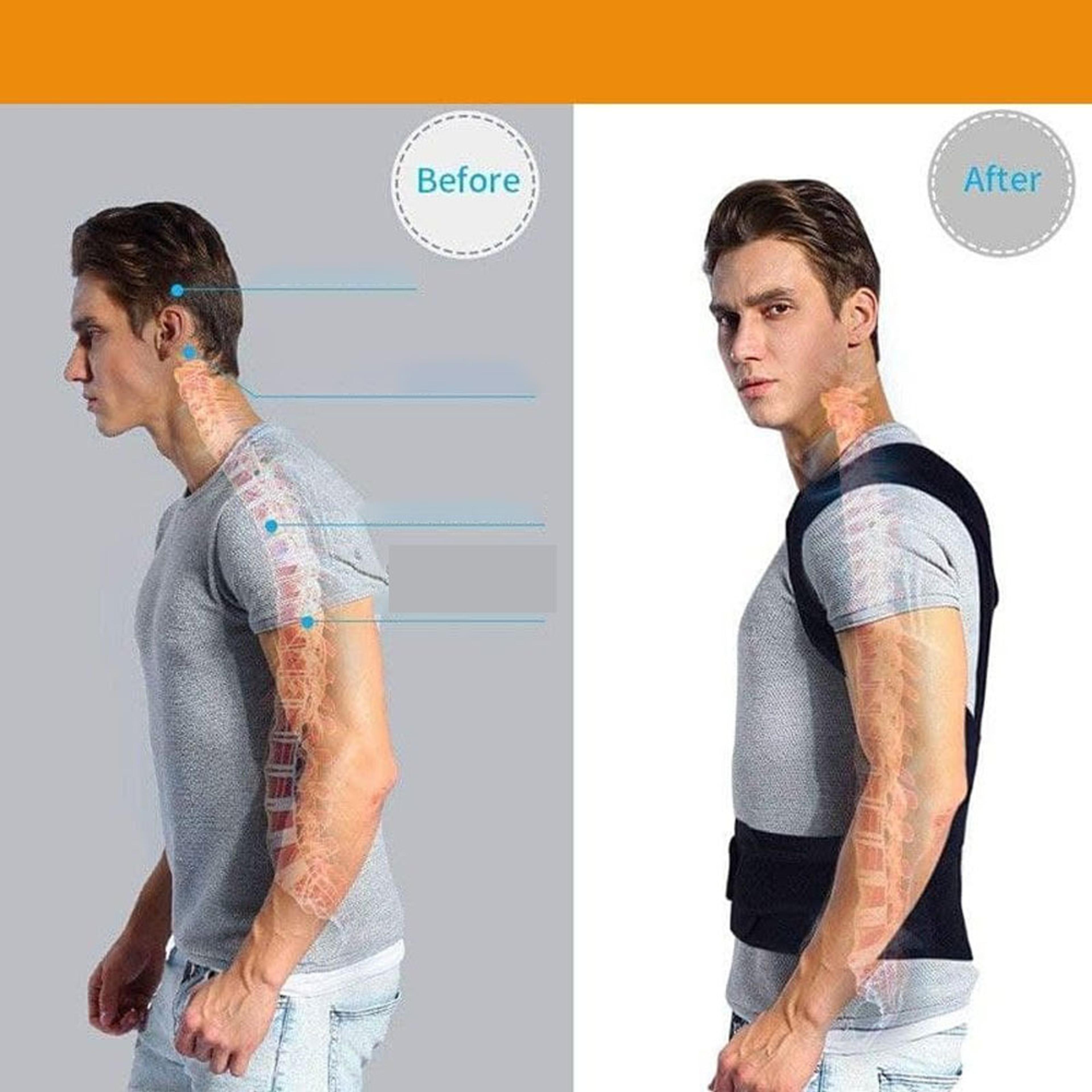 Adjustable Posture Corrector Brace For Men And Women Clavicle Support Stop Slouching And Improve Ba 1