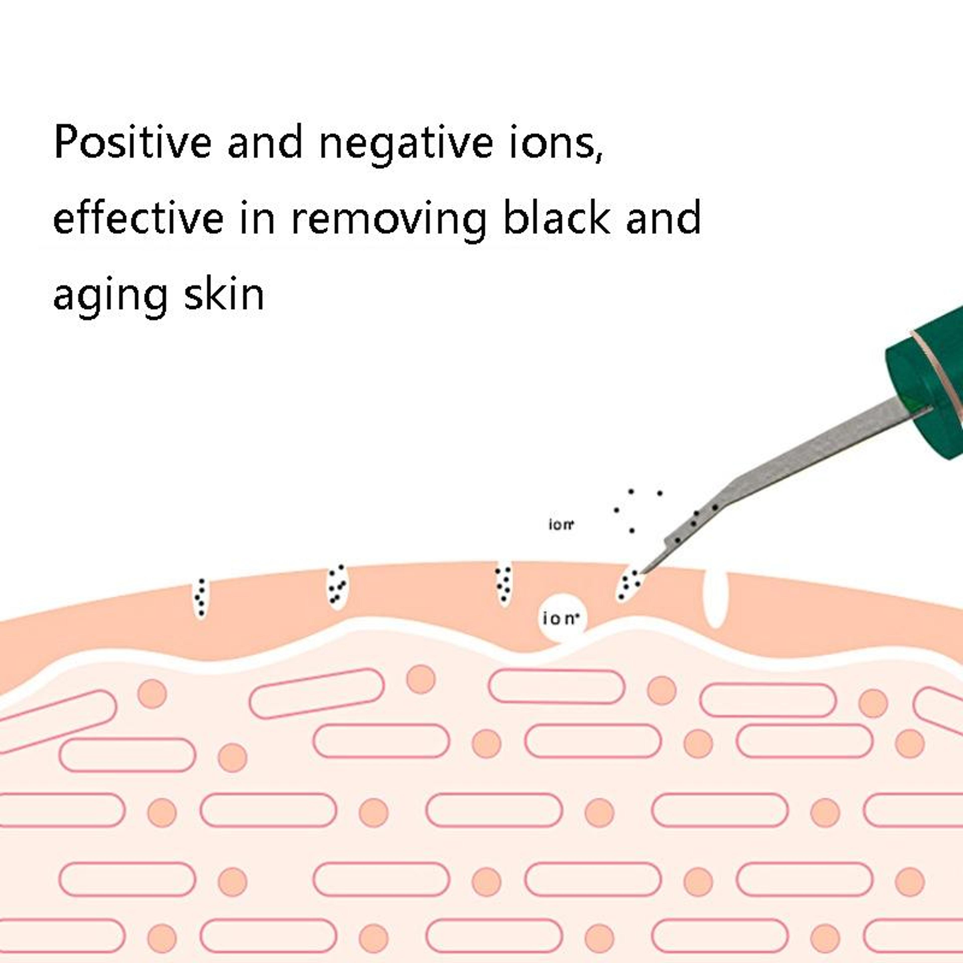 Ultrasonic Skin Scrubber Blackhead Remover With Ionic Deep Cleansing  Firming Modes 2