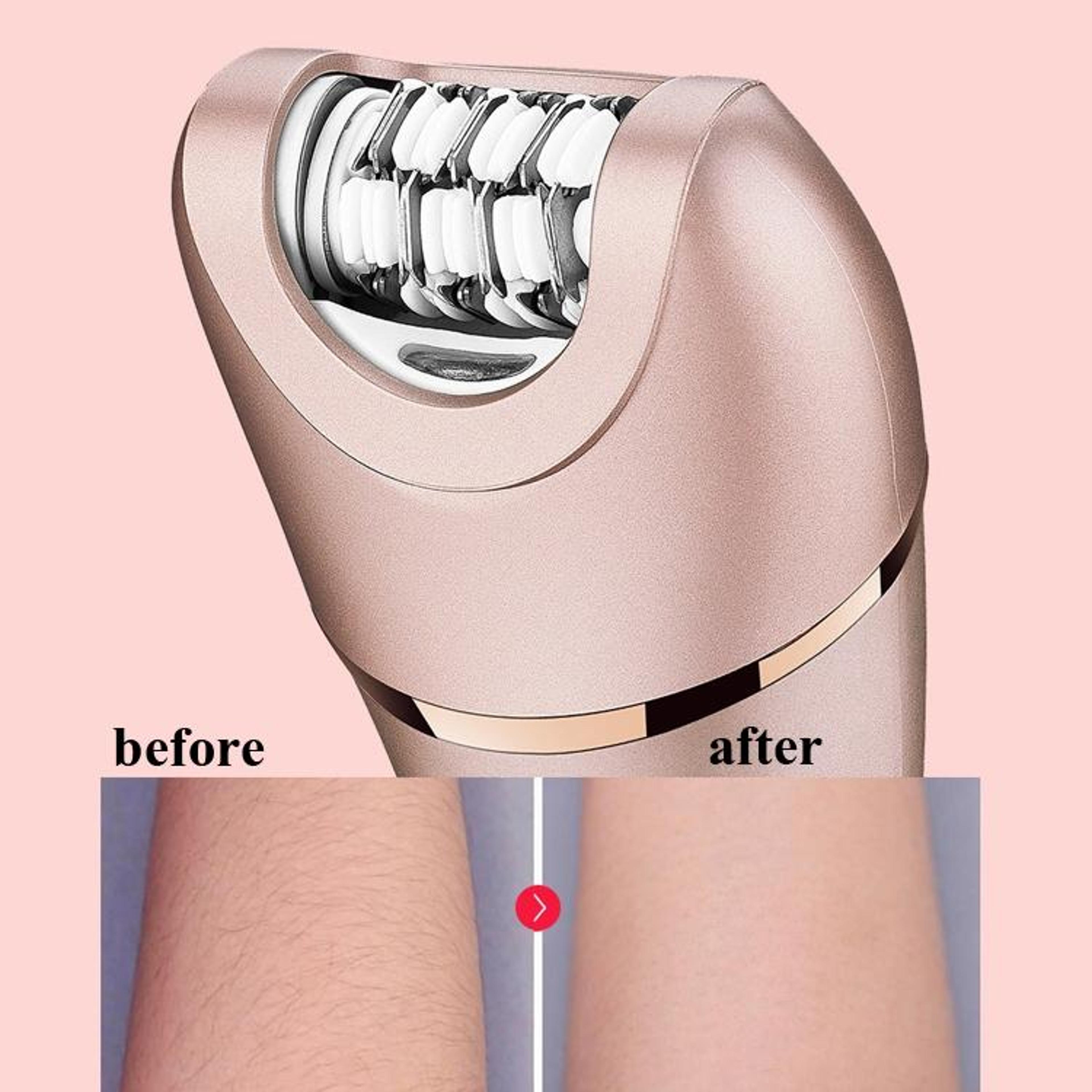 Suker 2 In 1 Electric Epilator  Womens Shaver Waterproof Hair Removal Device 6