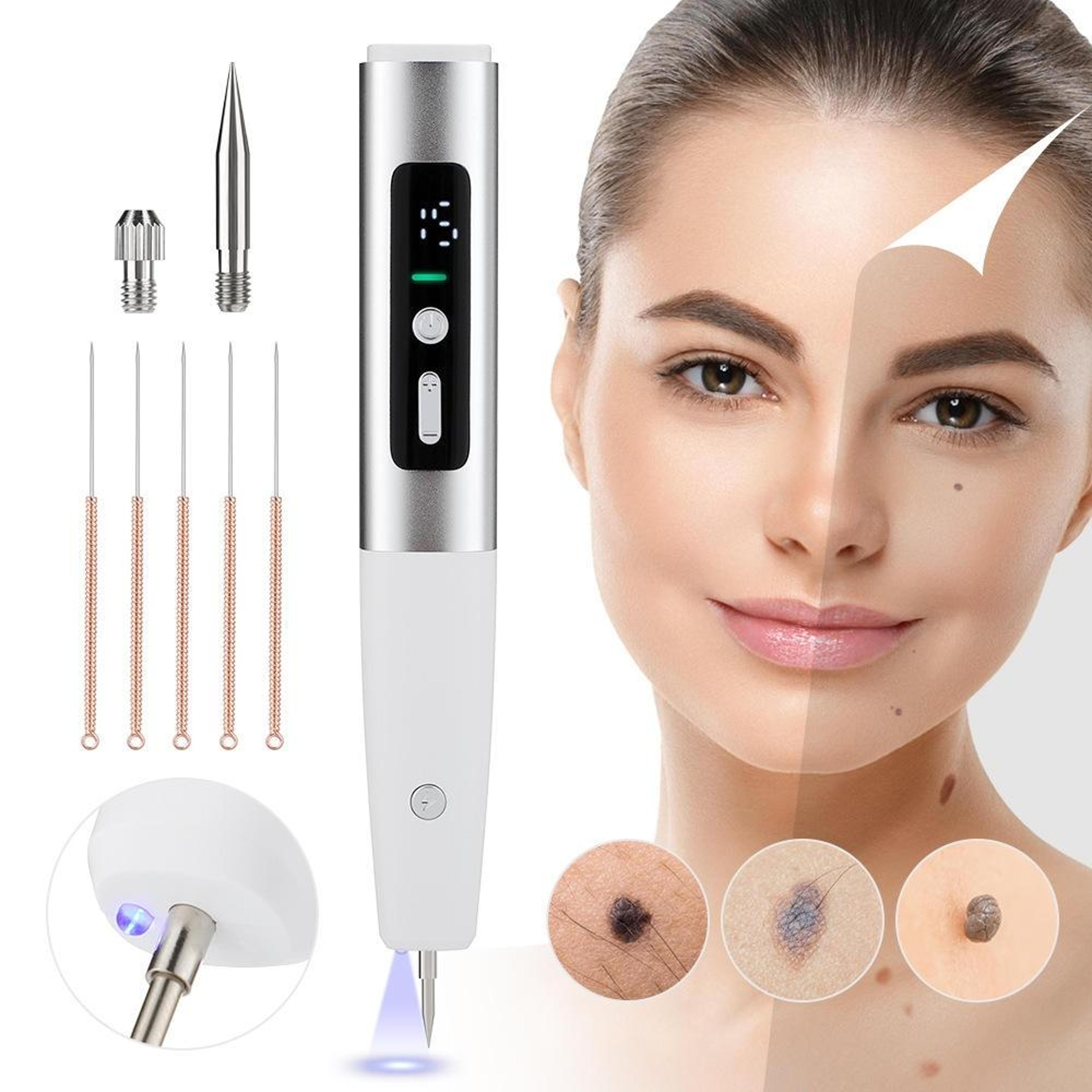 15 Speed Mole Removal Pen With LED Precision Light  USB Rechargeable Spot Corrector 2