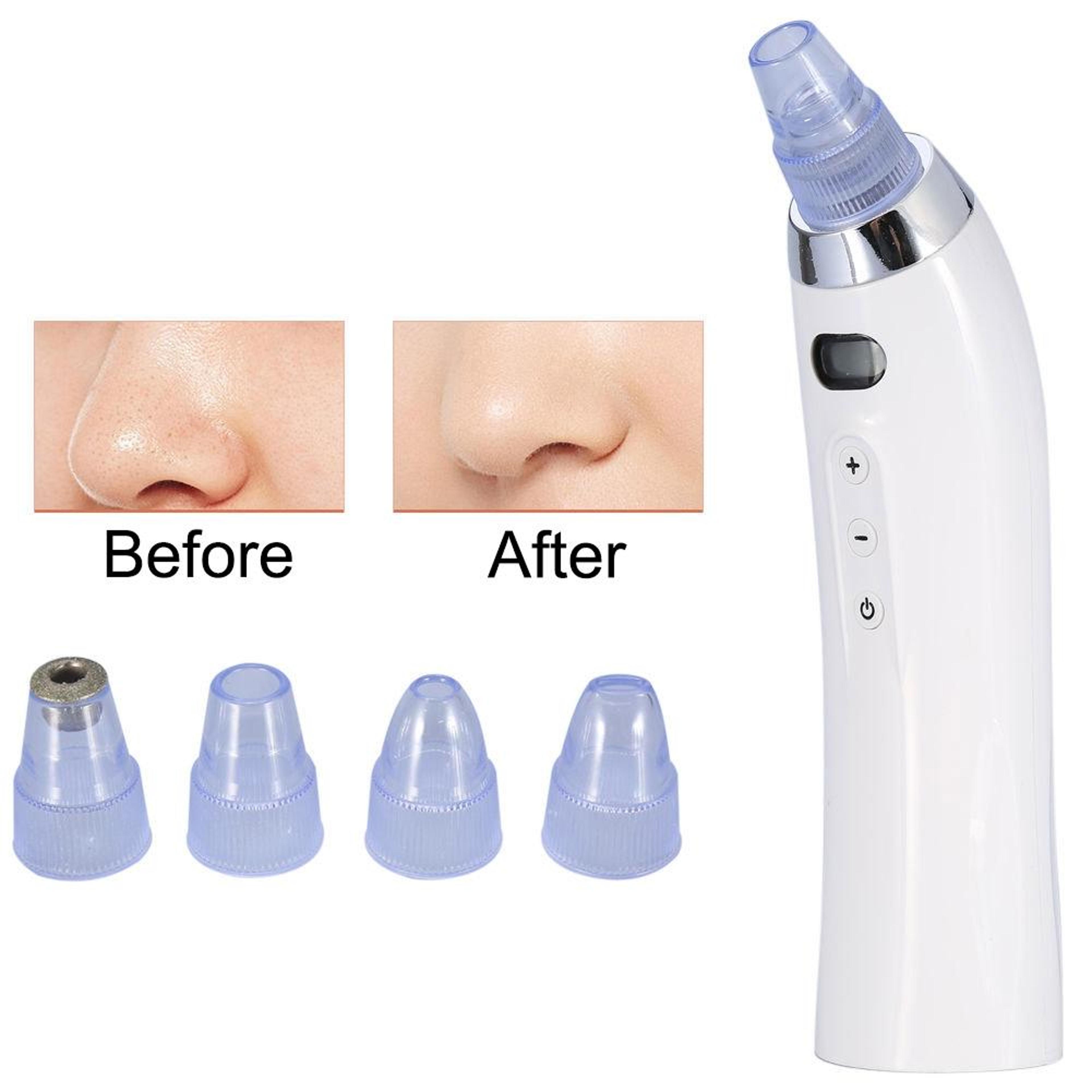 RadianceLift Blackhead Remover Vacuum  Diamond Microdermabrasion Pore Cleaner 6