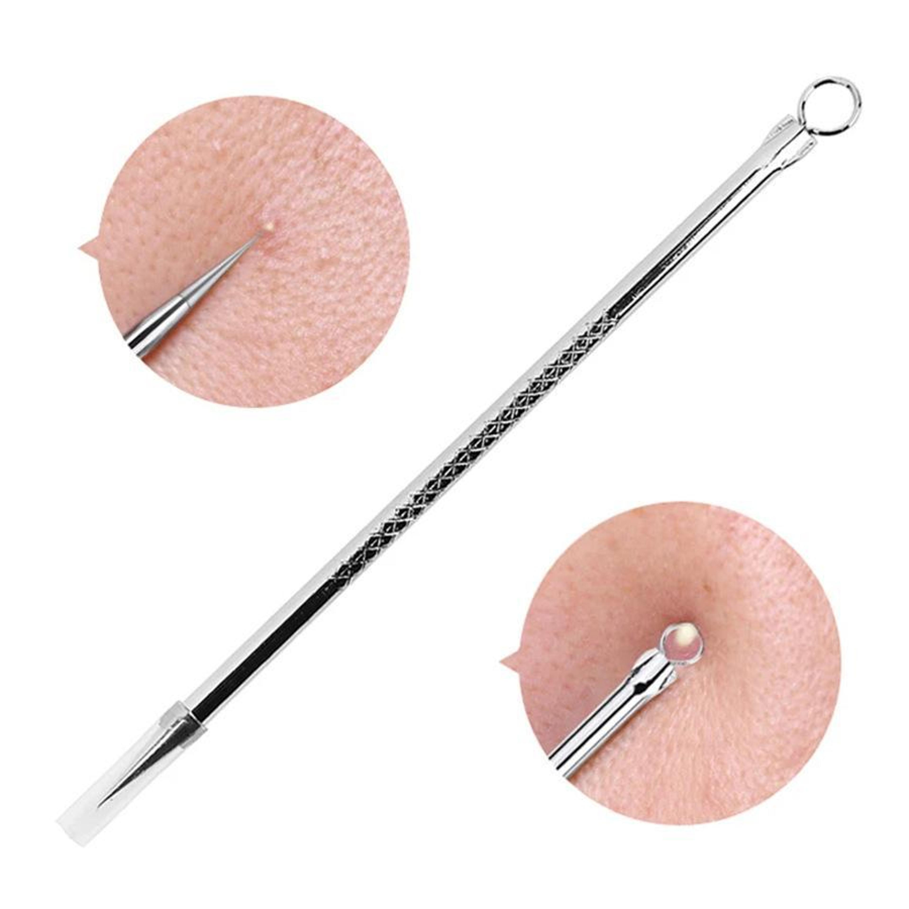 Precision Stainless Steel Blackhead Remover Tool Set For Acne Whiteheads  Deep Pore Cleaning 1