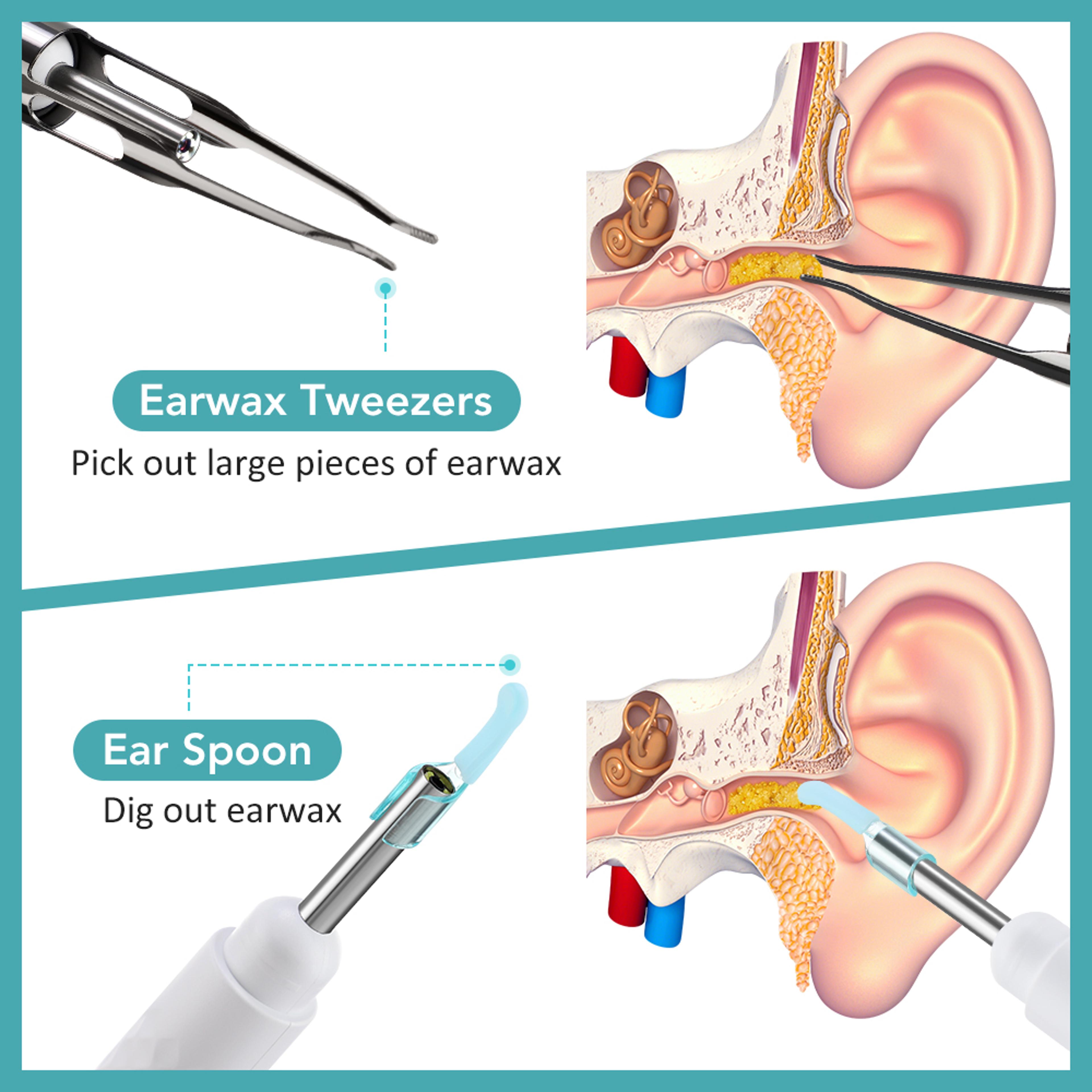 Ultra Thin 35MM Visual Wireless Otoscope HD Ear Scope With Ear Wax Cleaning Tools 1