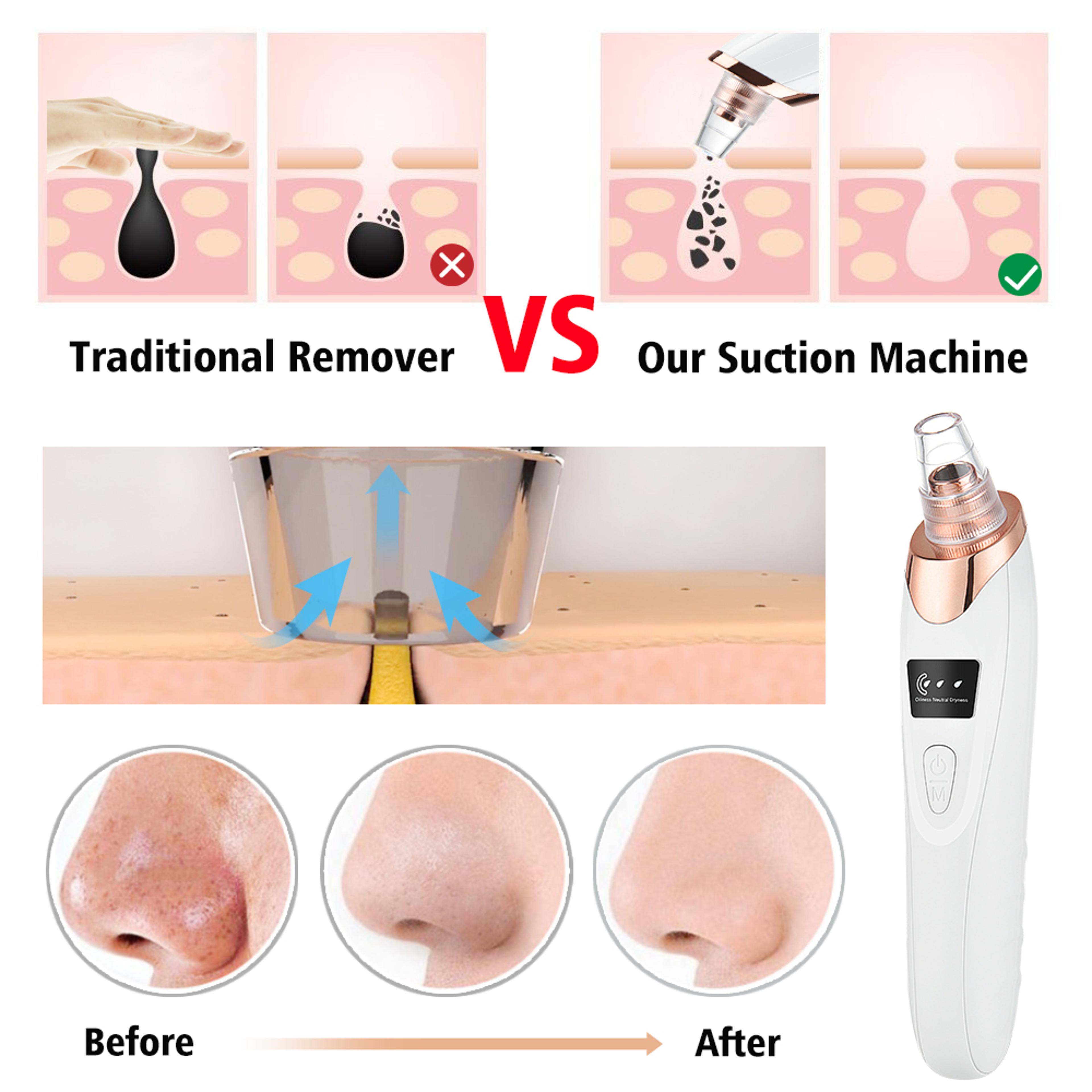 Electric Facial Blackhead Remover Black Spot Removal Machine Deep Pore Cleansing Skin Care Tool For 4