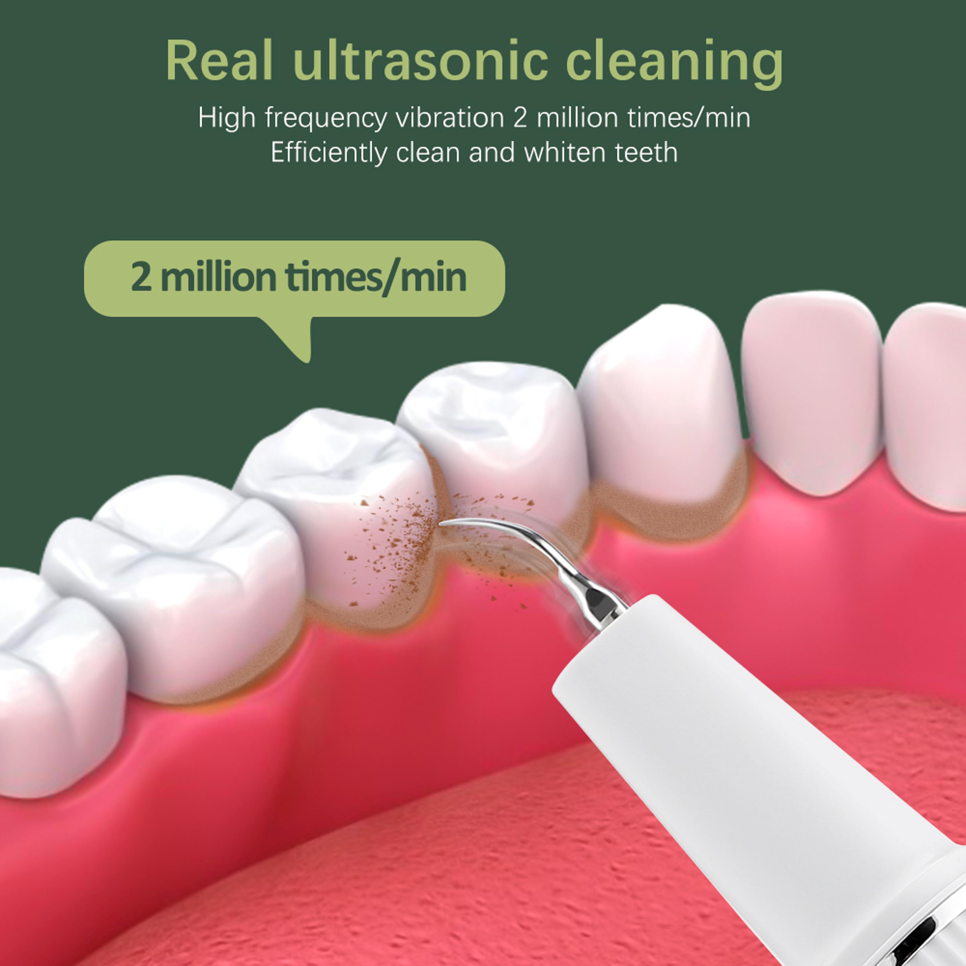 Portable Electric Ultrasonic Visual Scaler Dental Tartar Remover For Household Use 2