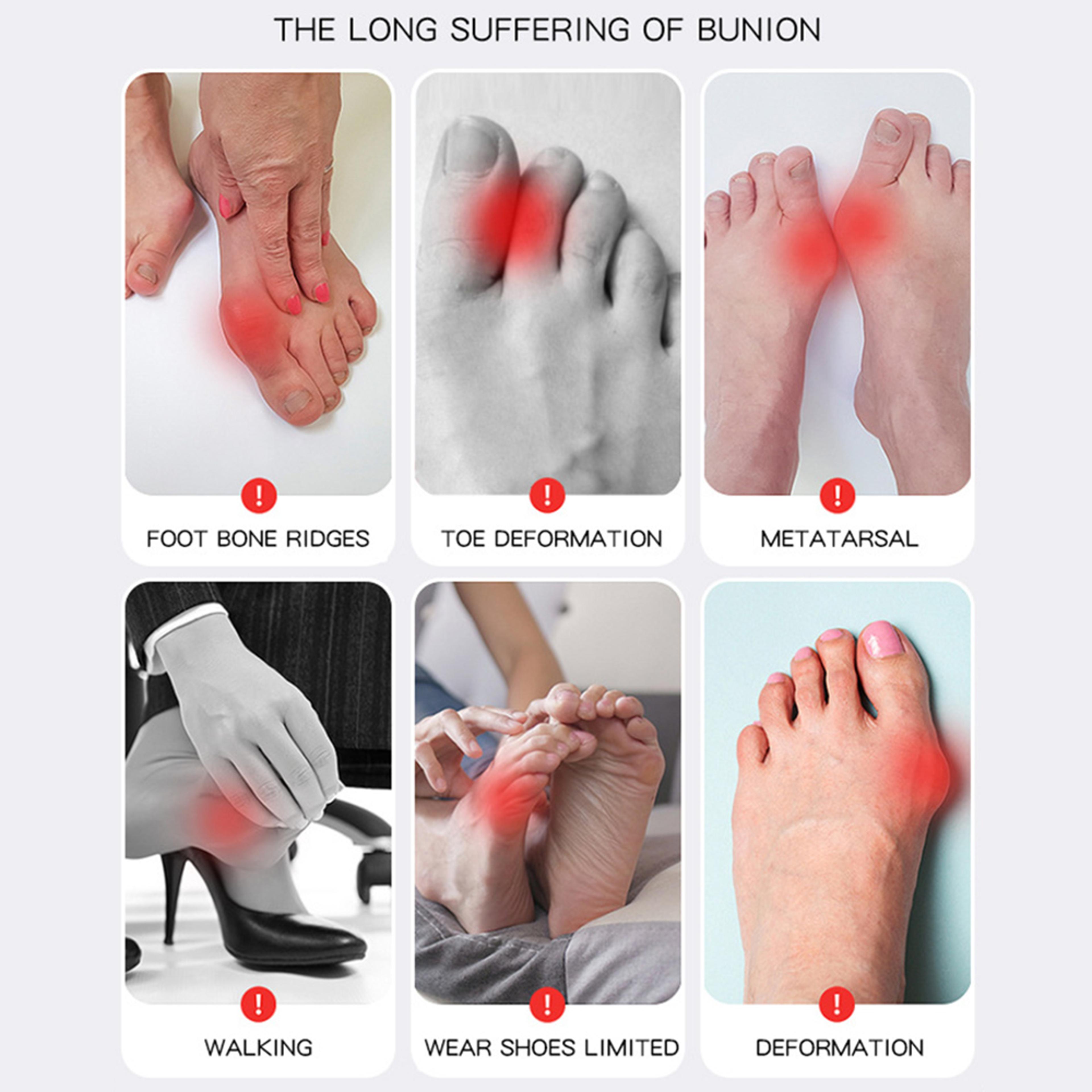 Adjustable Orthopedic Socks Big Toe Bunion Corrector Toes Separator For Pain Relief Hallux Valgus F 5