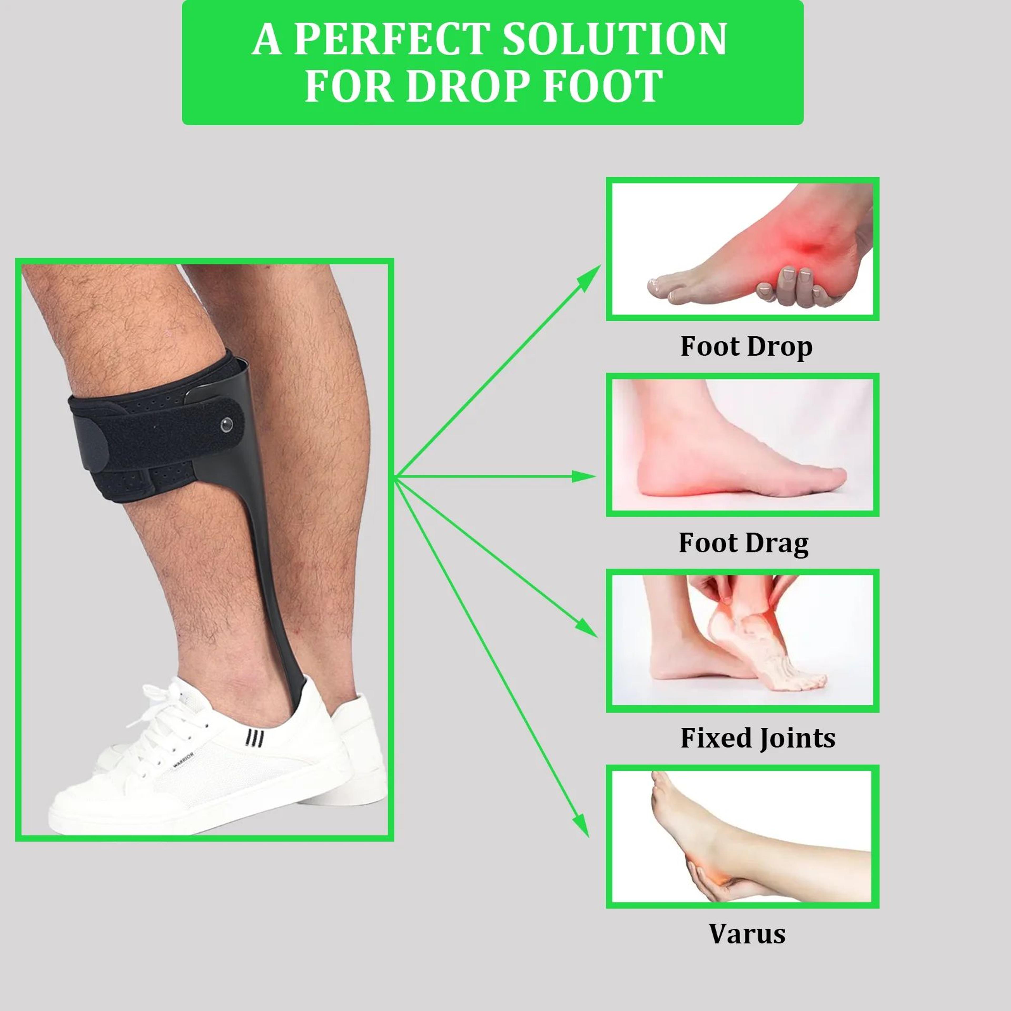 nerve damage ankle support