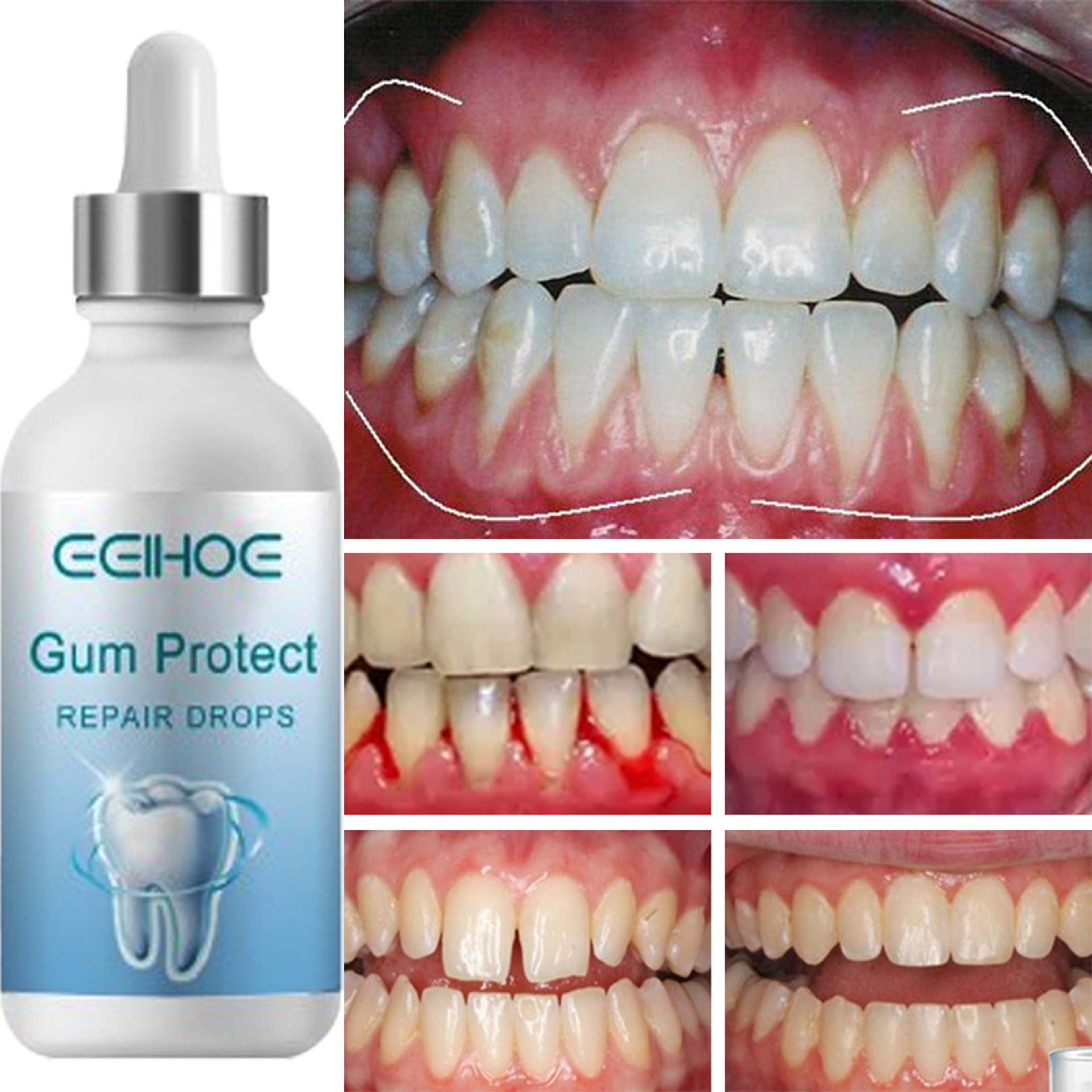 Rapid Repair Gums Serum Instant Relief For Tooth Sensitivity  Gum Health 1