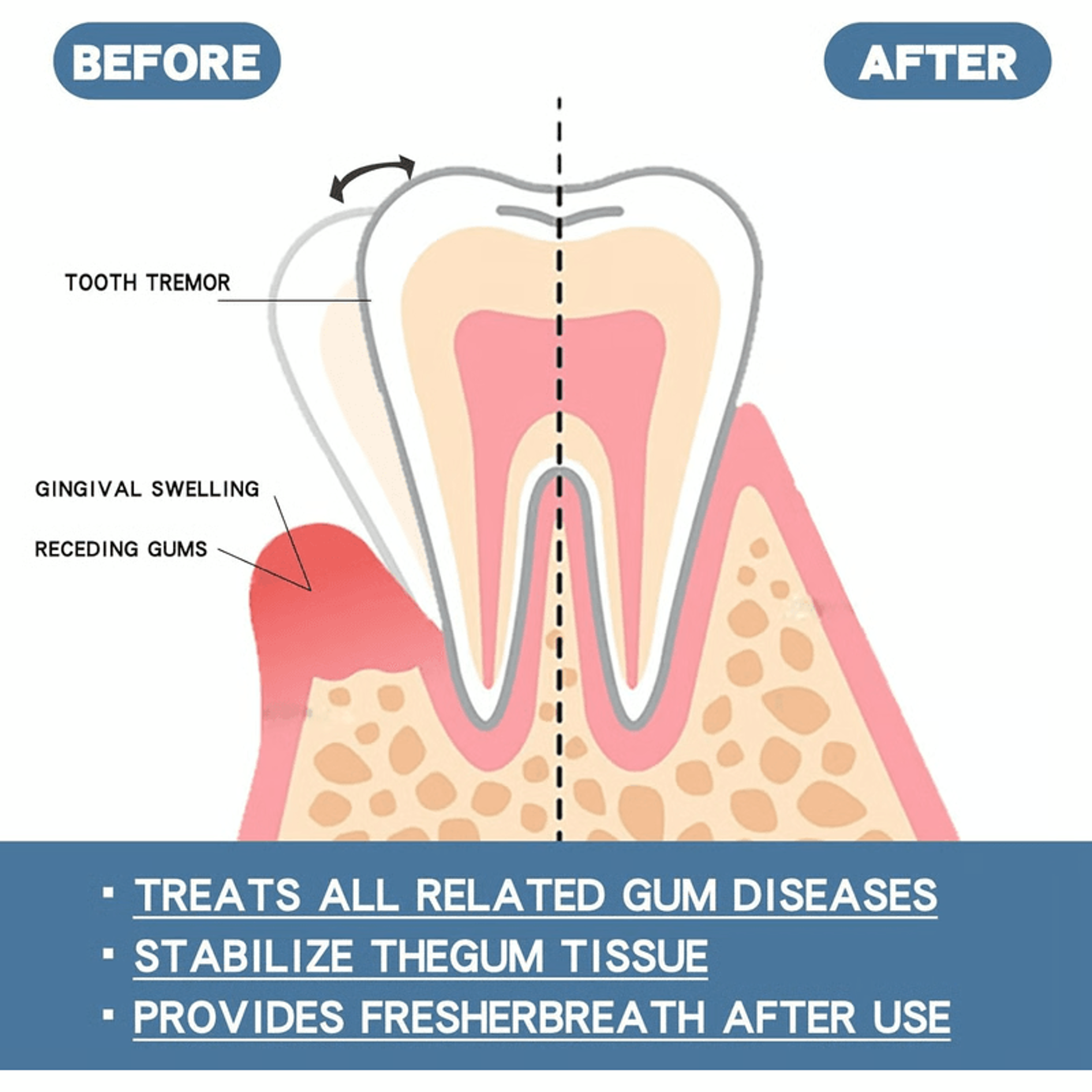 Rapid Repair Gums Serum Instant Relief For Tooth Sensitivity  Gum Health 11