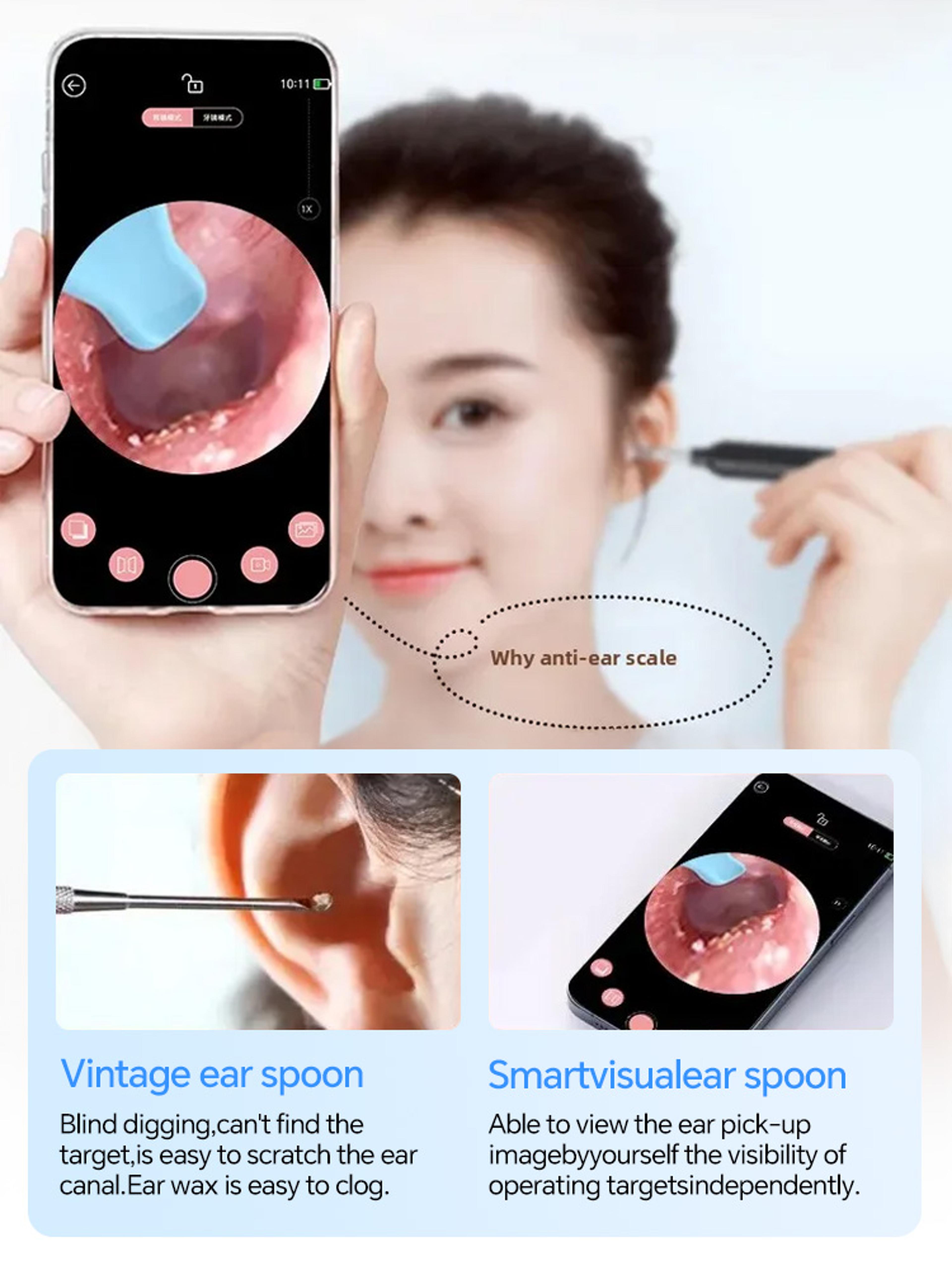 Smart HD Ear Cleaner Camera With LED Light Visual Earwax Removal Tool 2