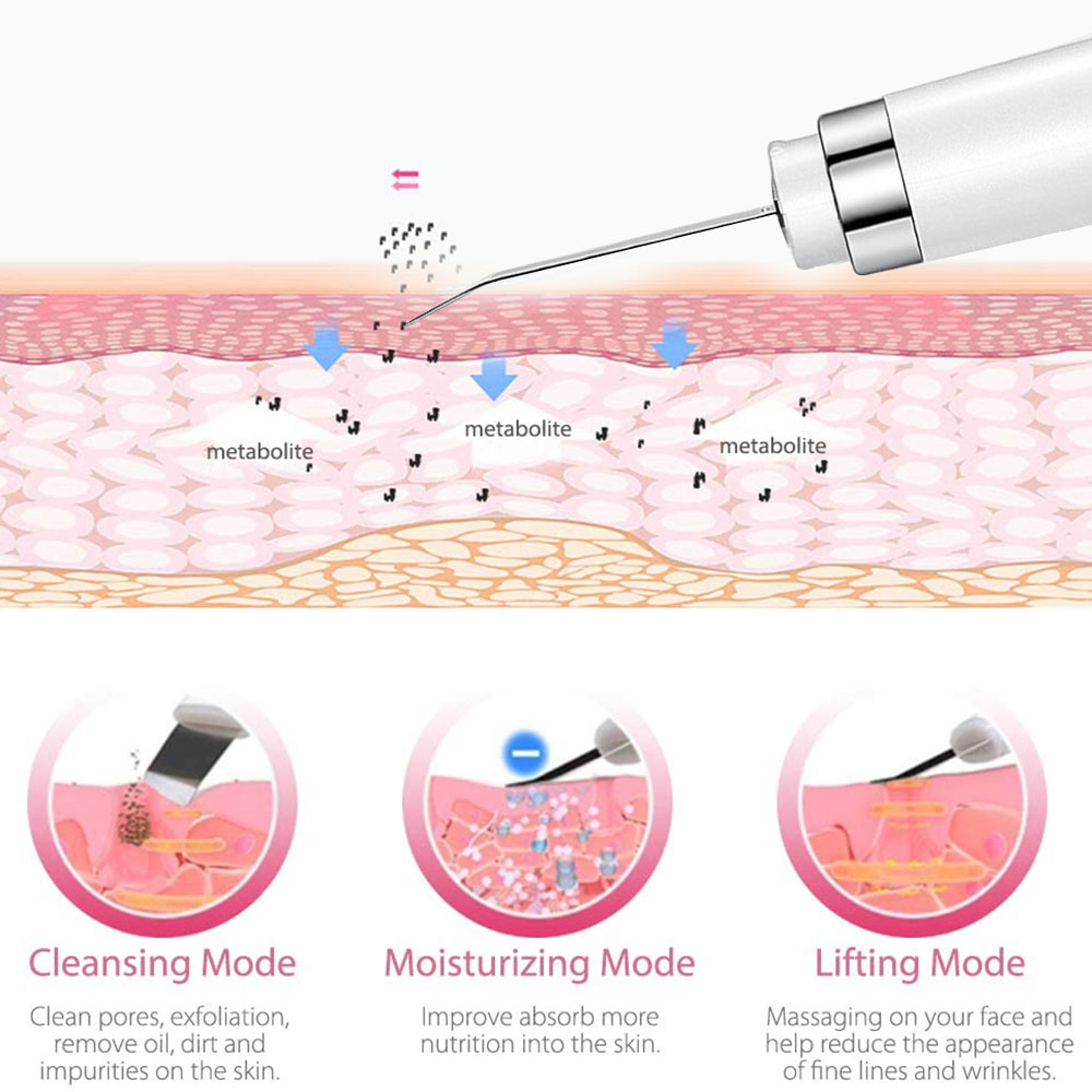 Ultrasonic Skin Scrubber Deep Pore Cleanser Blackhead Remover 1