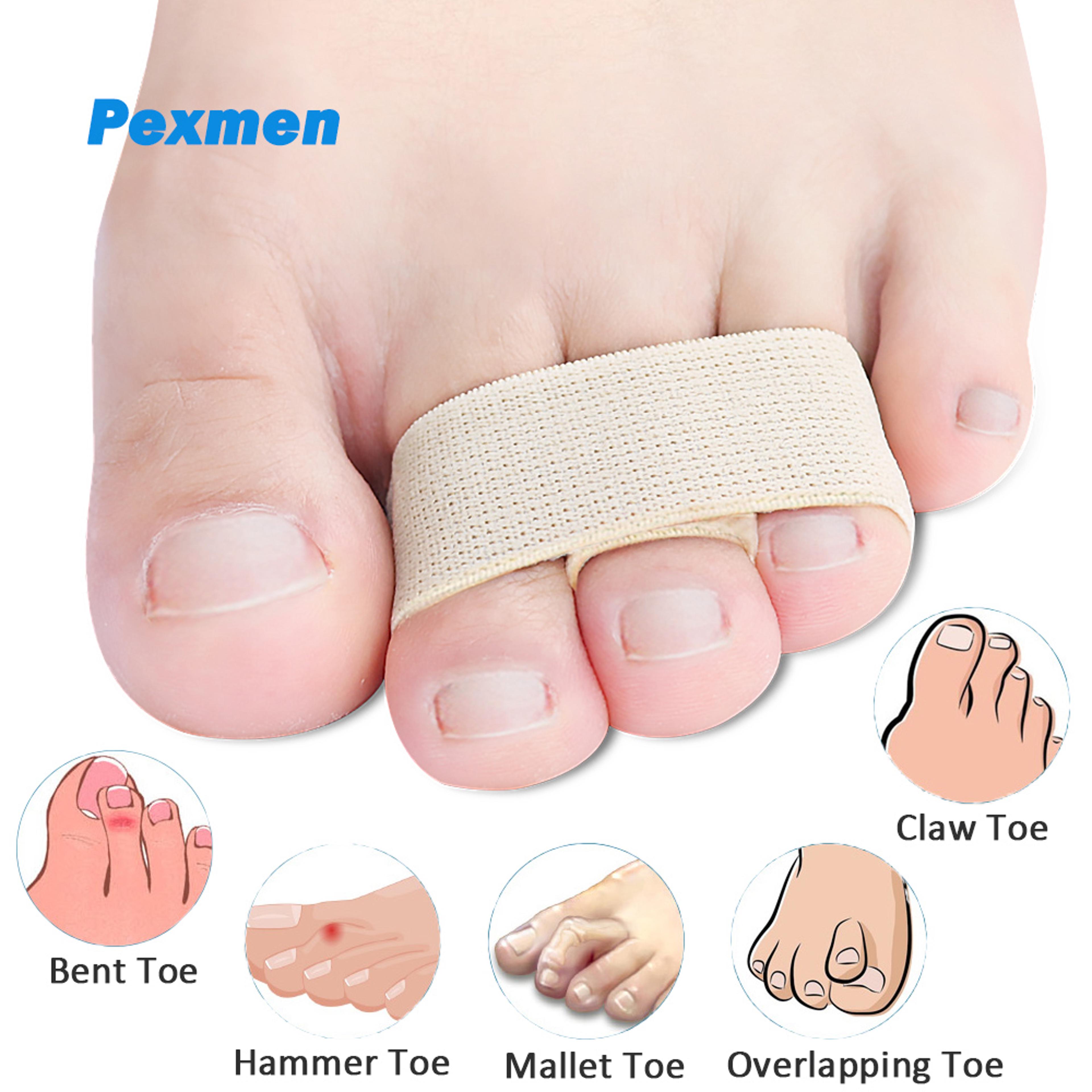 hammer toe straightener splints for bent and overlapping toes