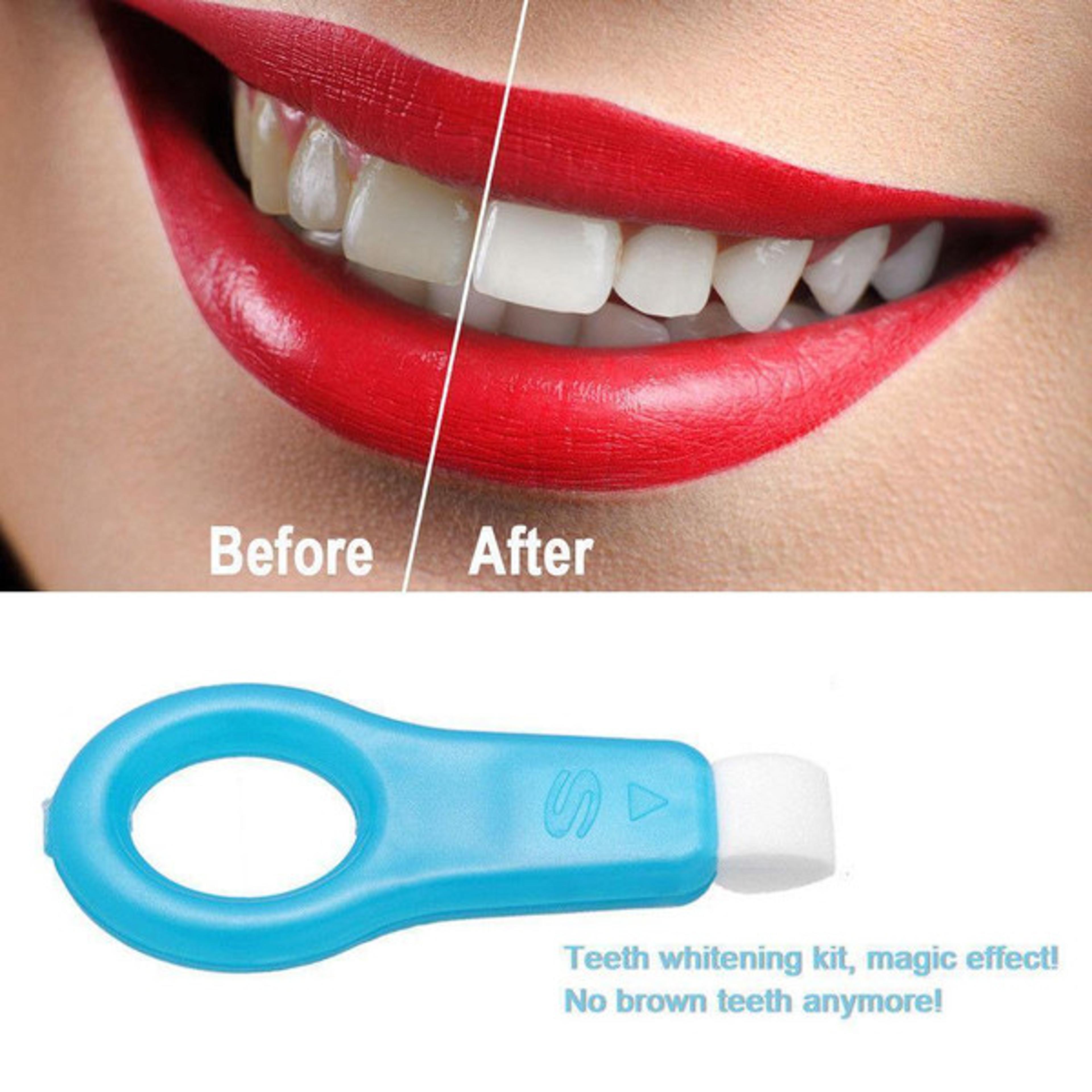 Nano Teeth Whitening Kit 1
