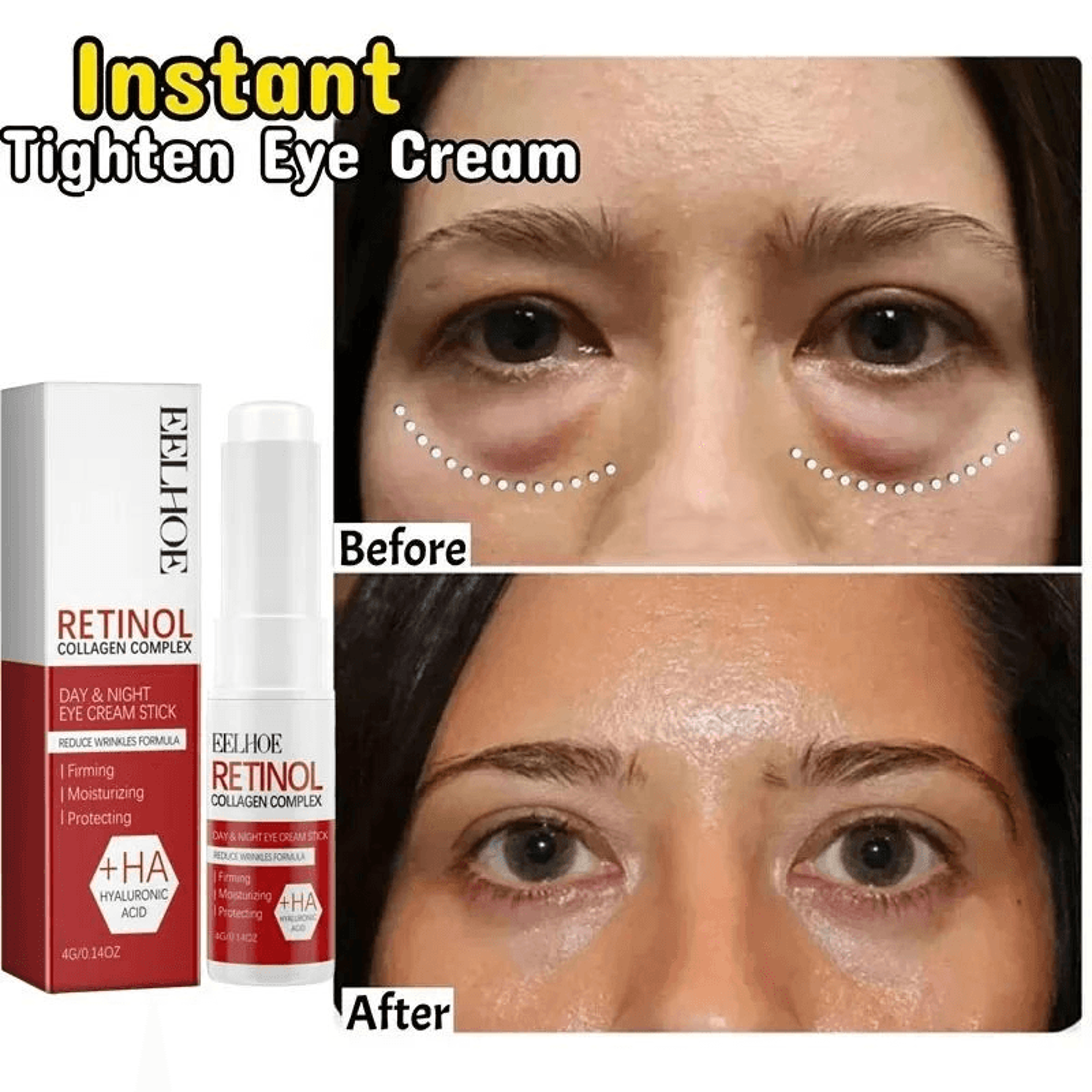 reducing eye bags skincare routine