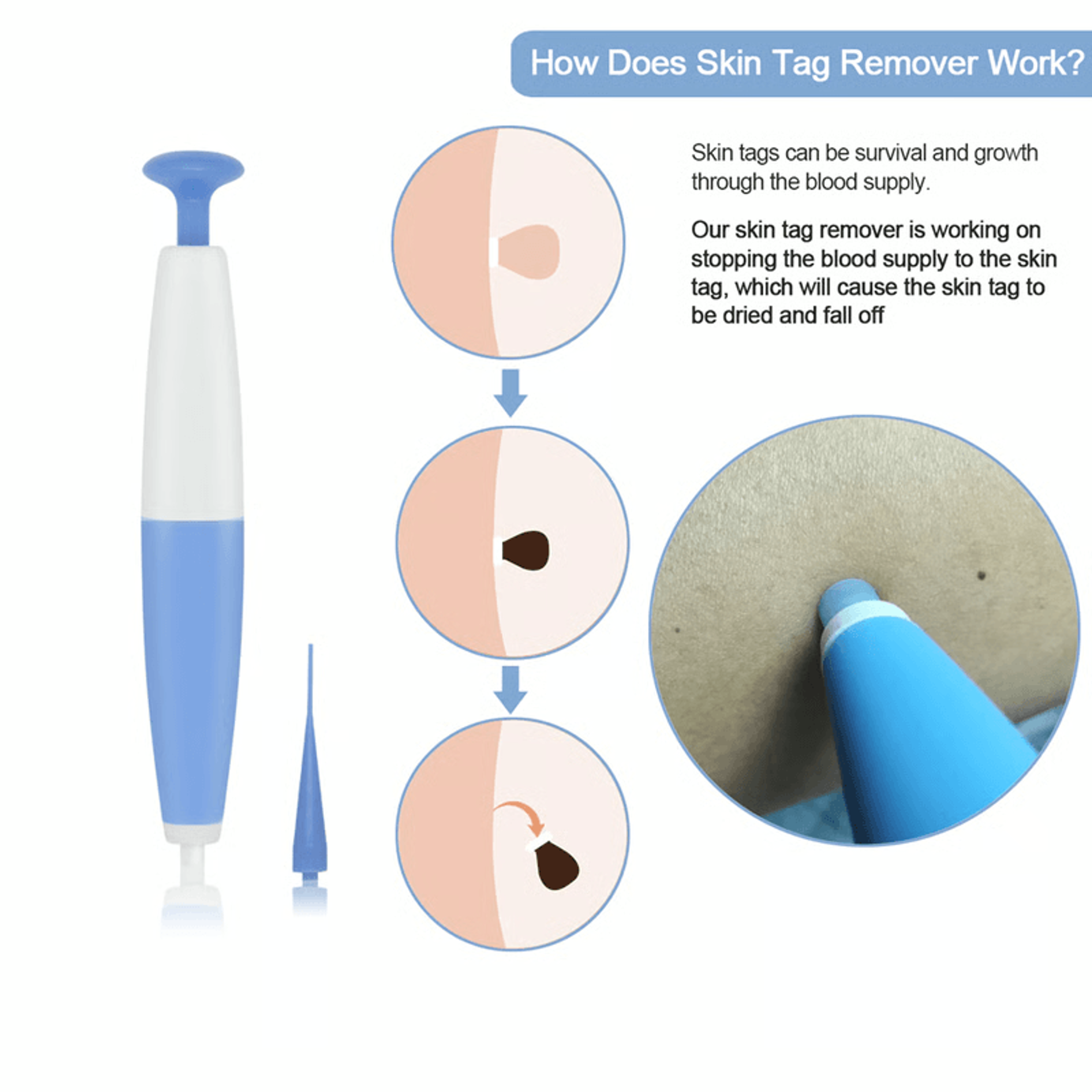 natural method to remove skin tags