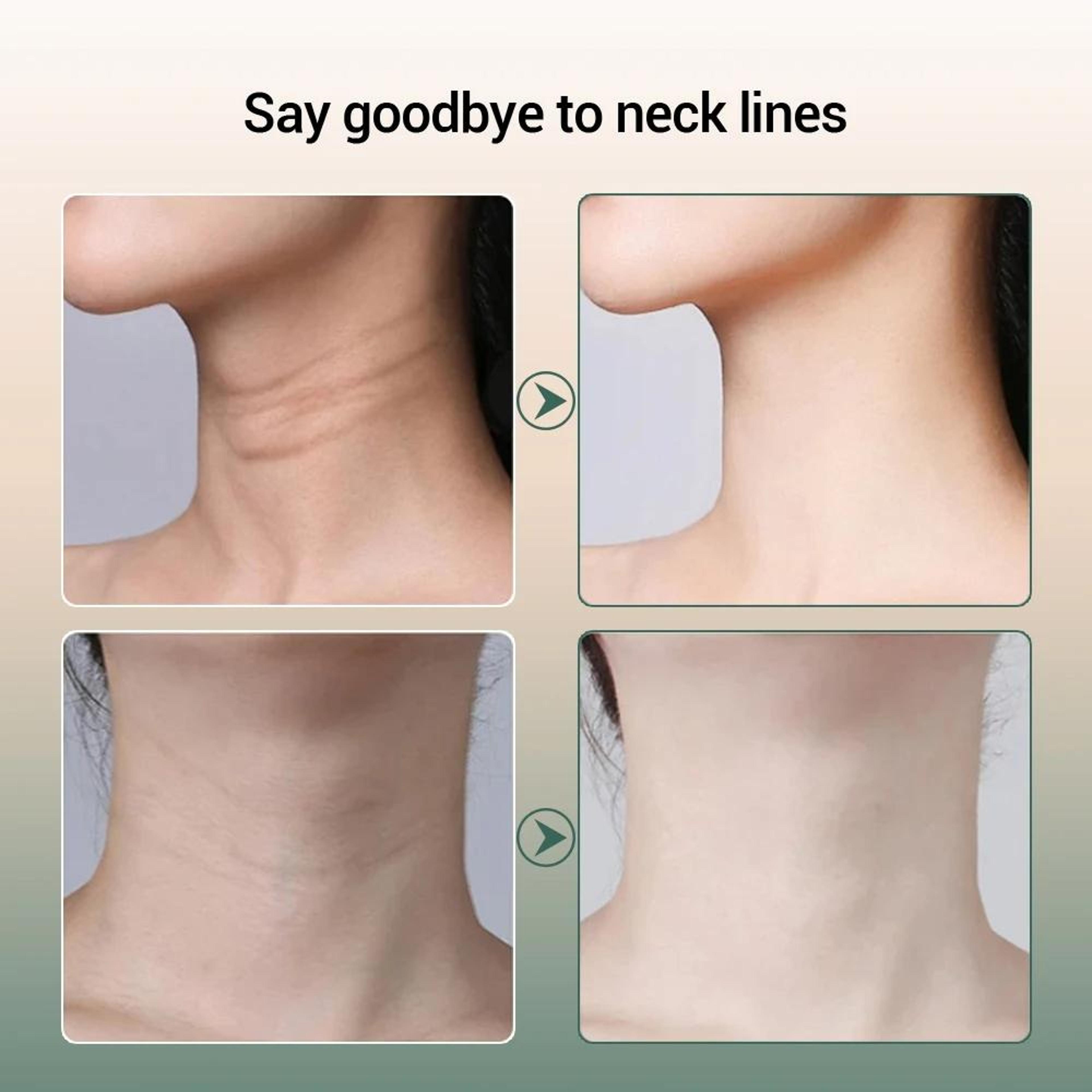 Microcurrent Neck Massager With LED Light Therapy 10