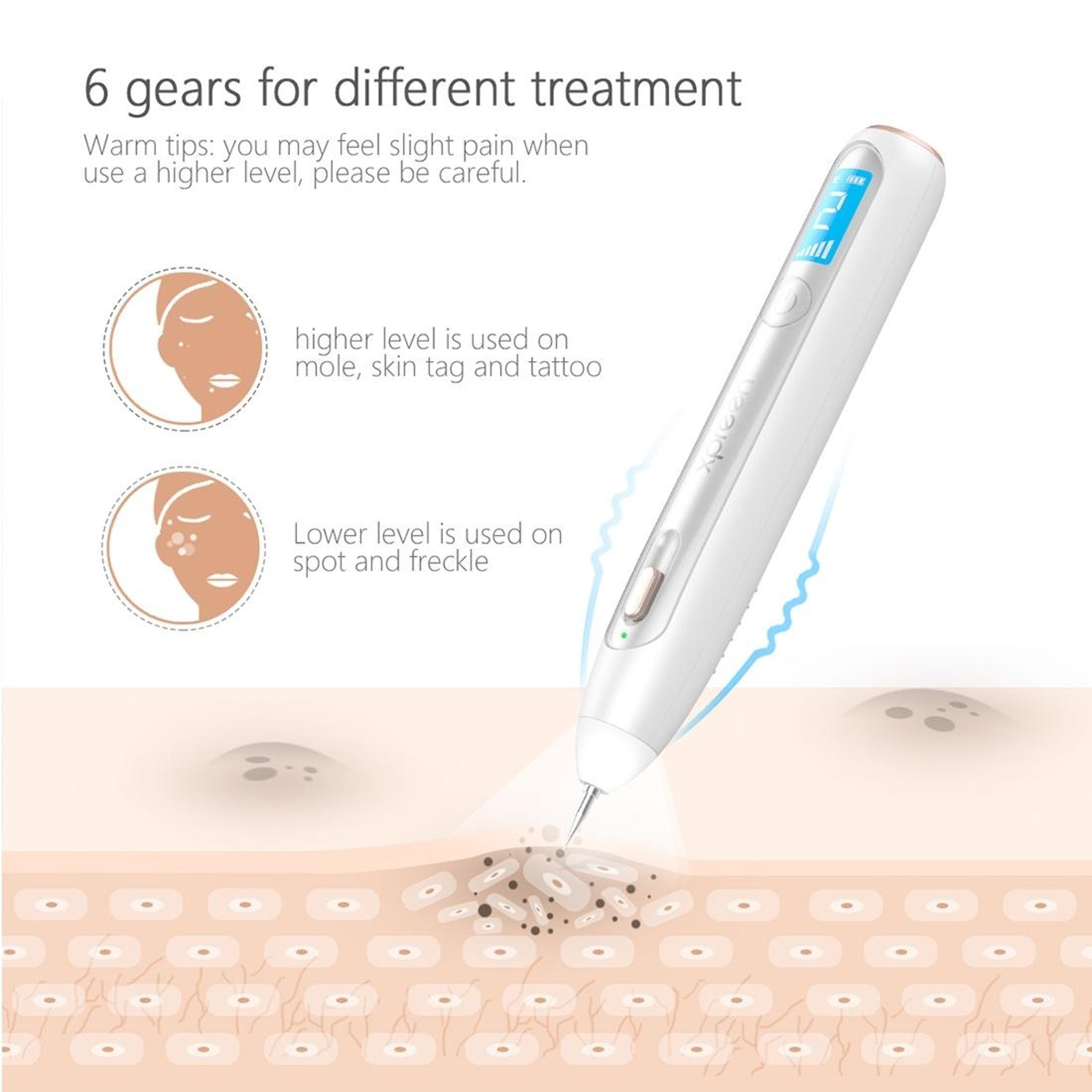 XPREEN Rechargeable Skin Tag Remover Pen With LED Spotlight 5