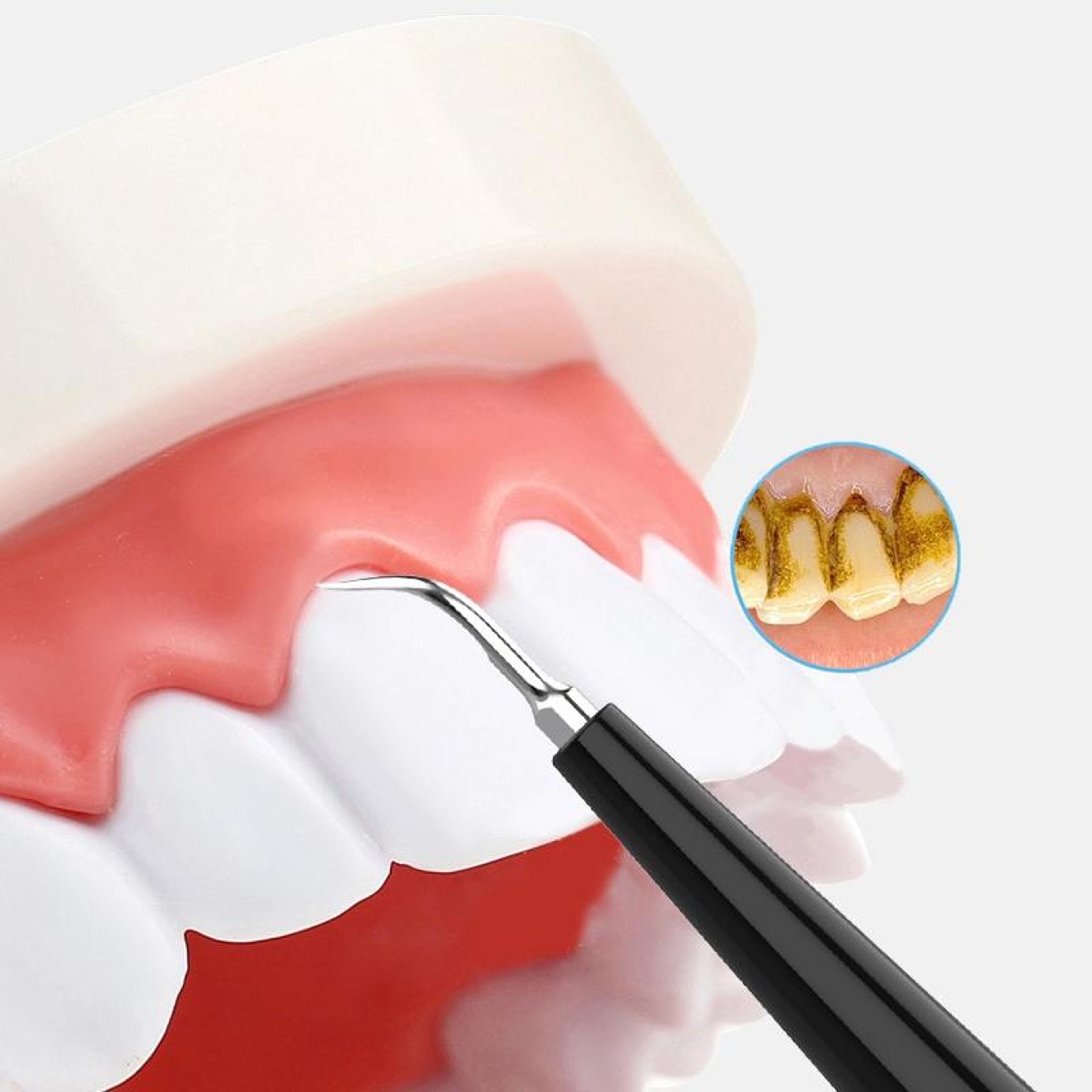 Electric Dental Scaler Teeth Cleaning Tool With LED Light For Tartar Plaque And Stain Removal 4