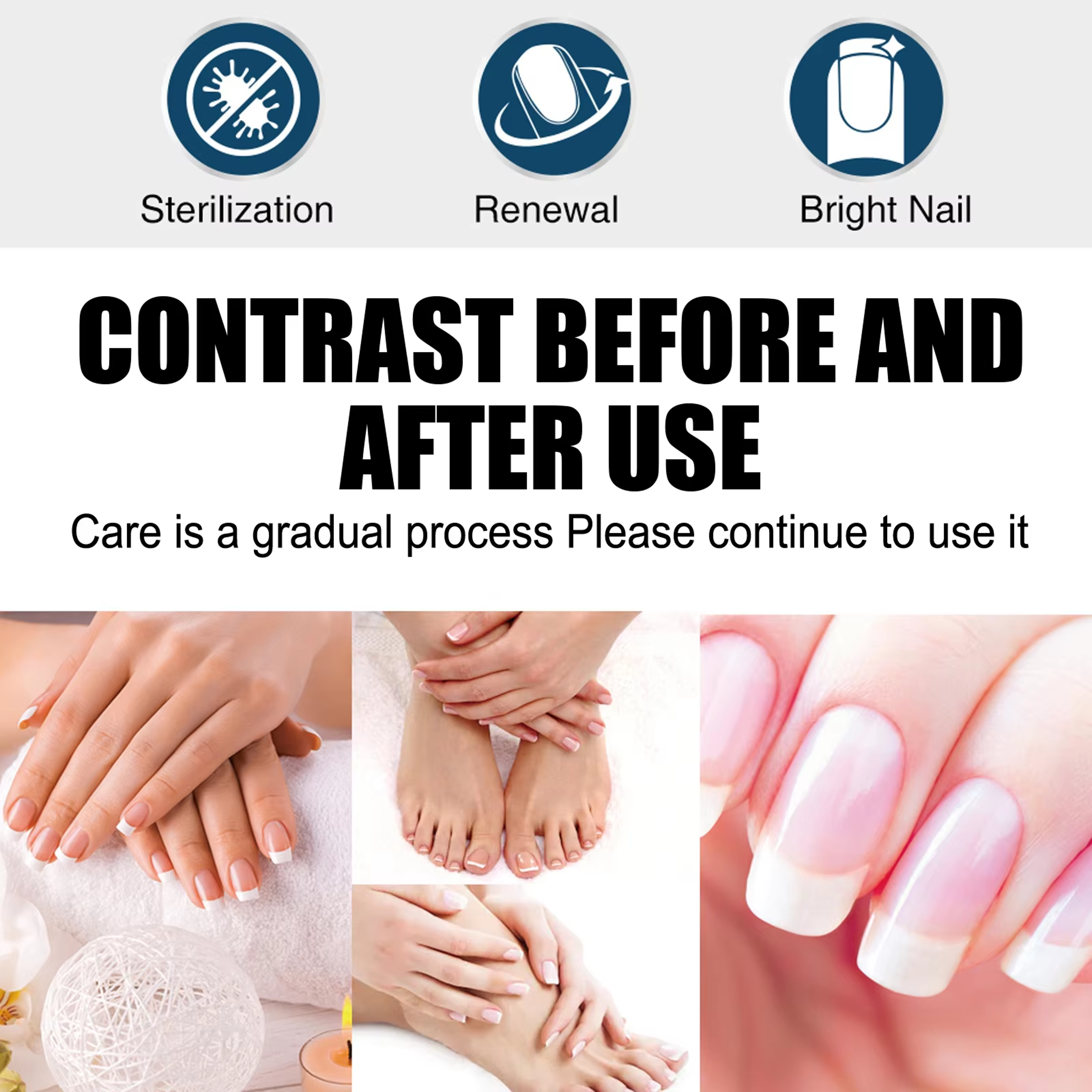 South Moon Nail Fungus Repair Pen For Toenail Care And Nail Brightening 5