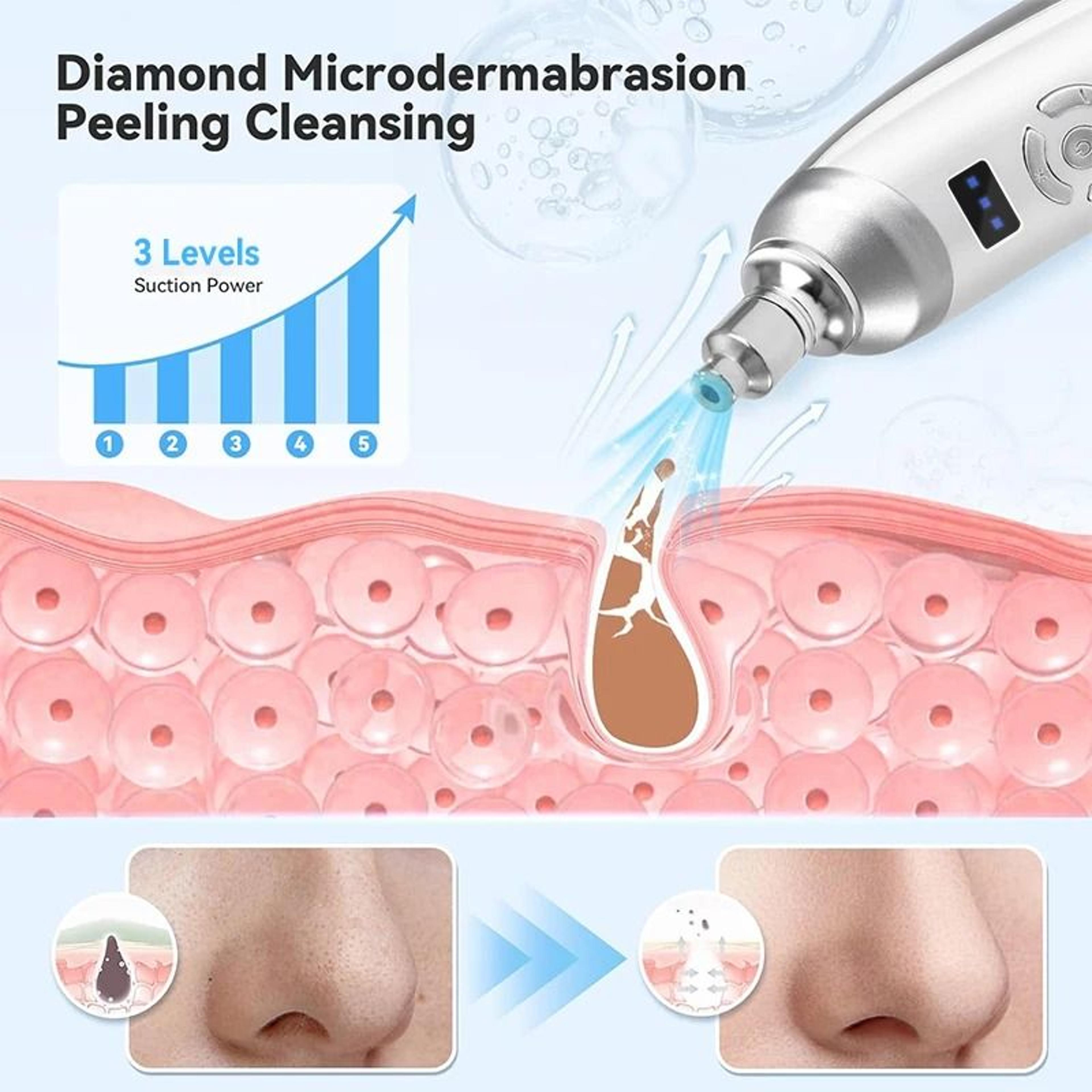 Diamond Microdermabrasion Machine For Blackhead Removal And Facial Deep Cleansing 3