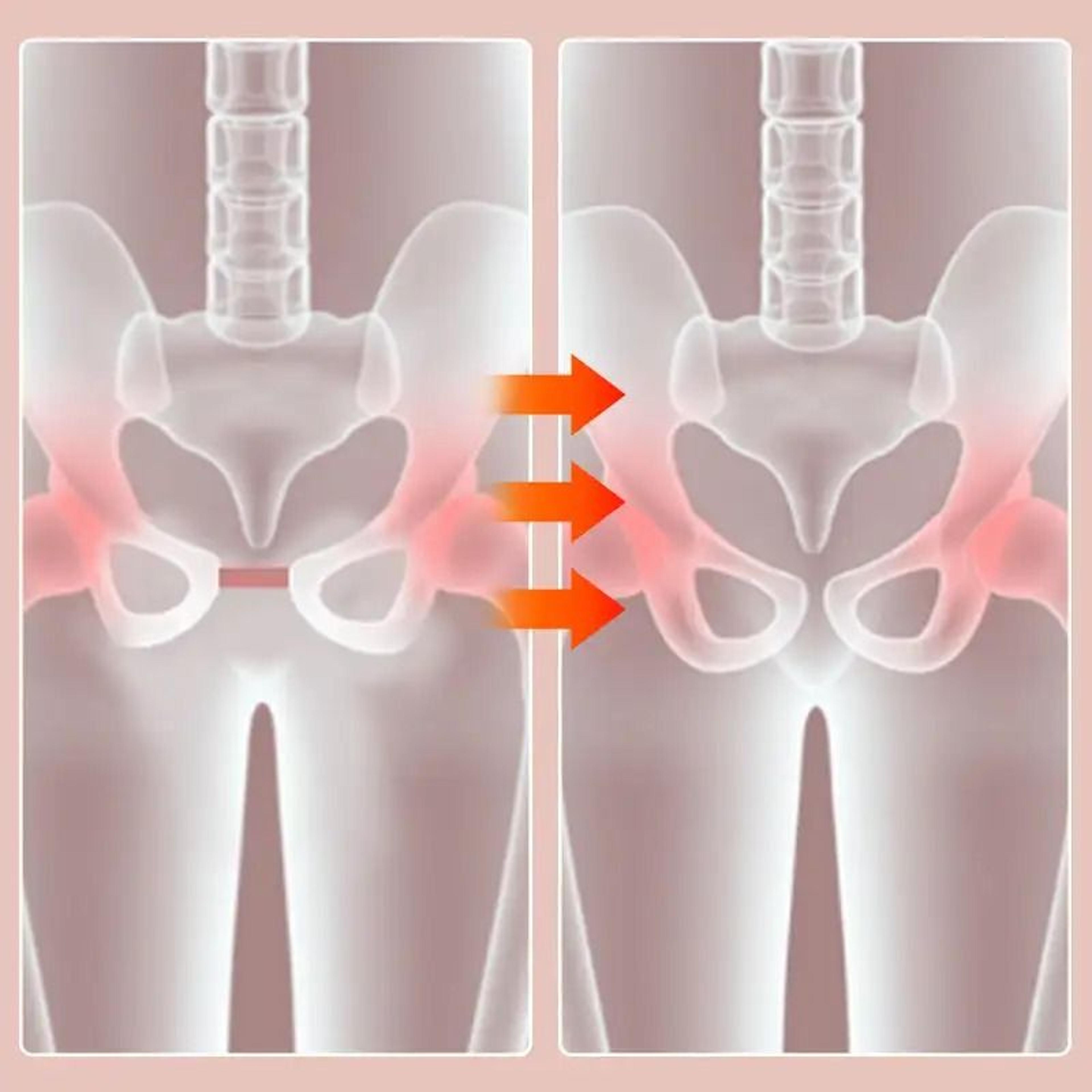 Pelvic Floor And Thigh Exerciser Non Slip Comfortable Postpartum Recovery Trainer 4