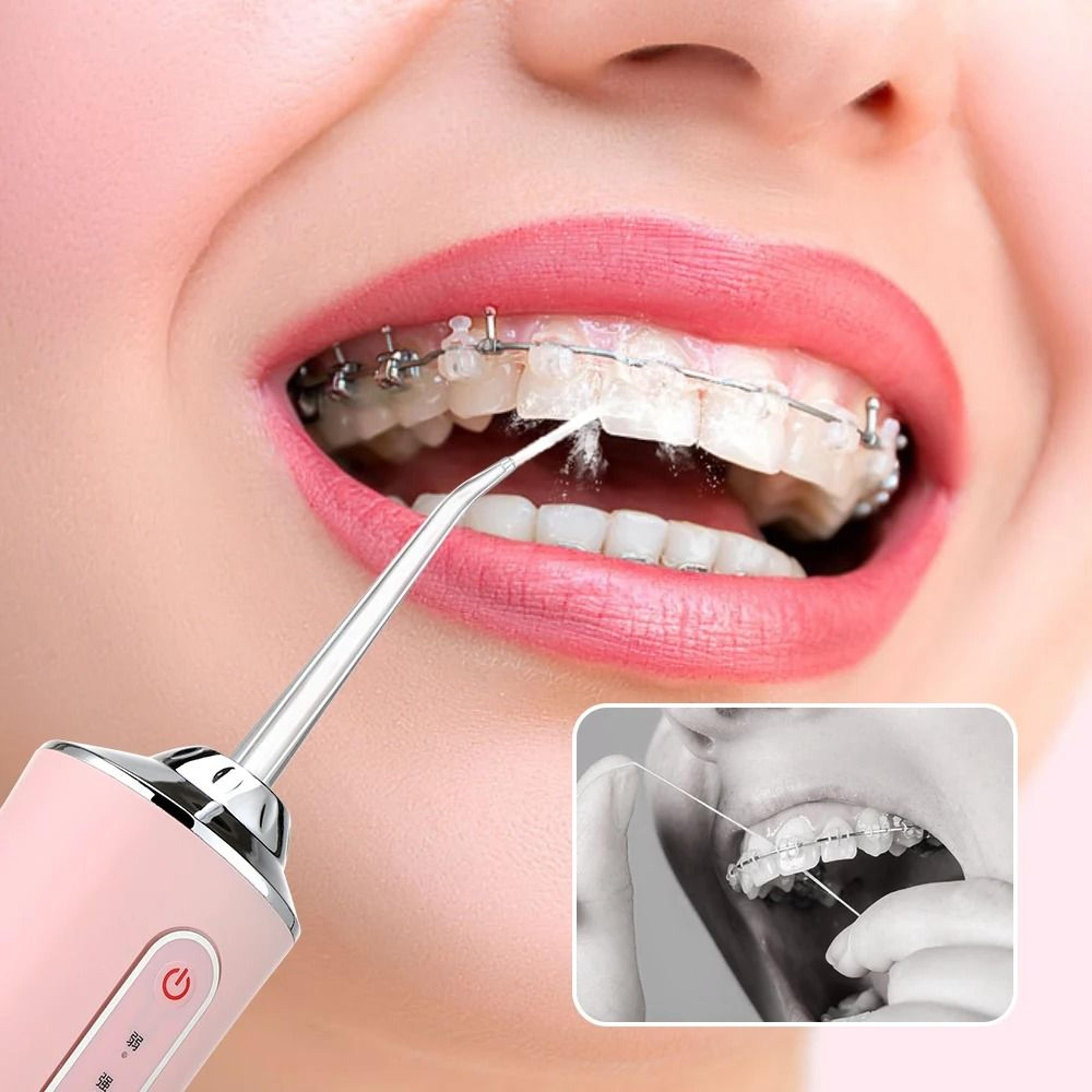 Portable Dental Water Flosser With USB Rechargeable Jet And 3 Cleaning Modes 2