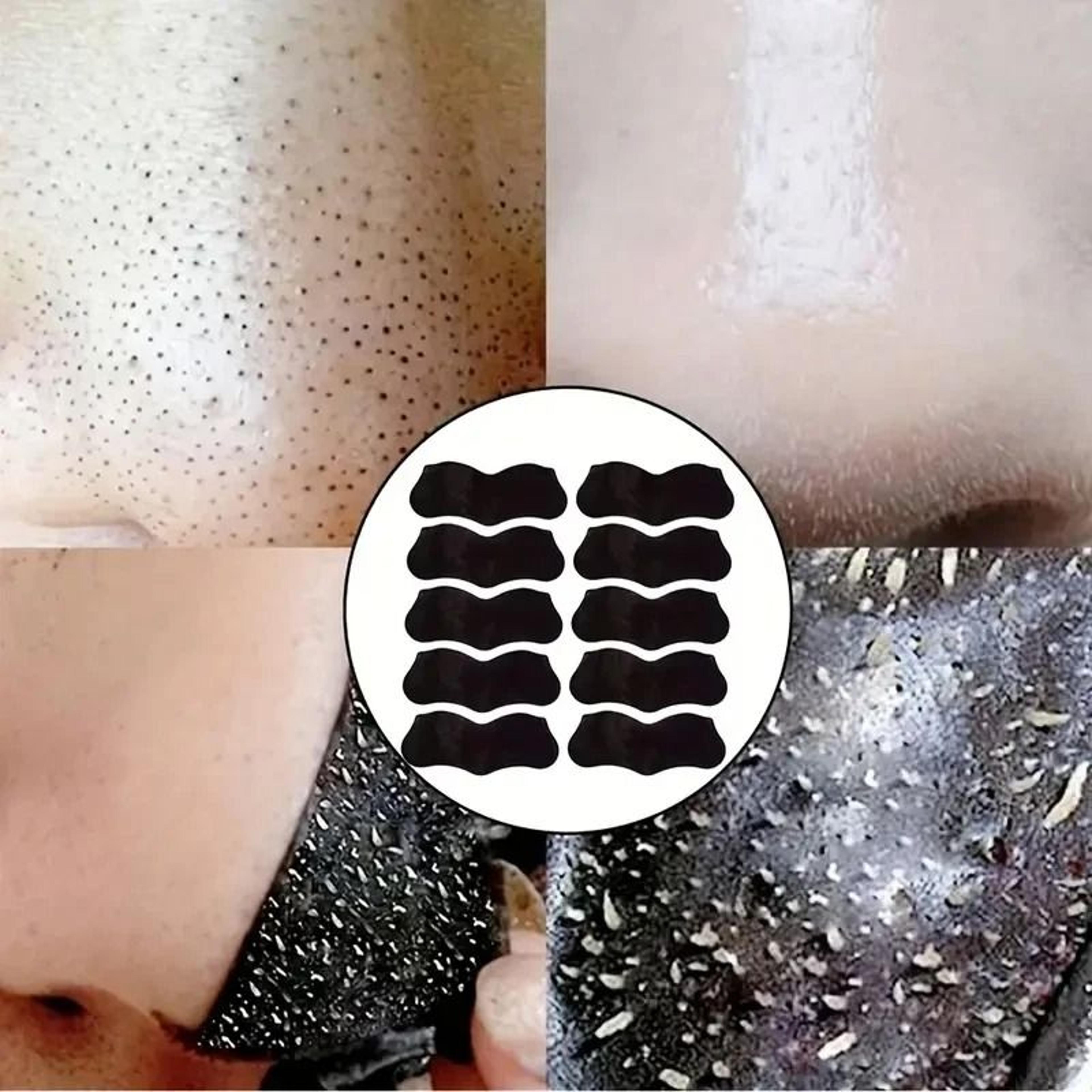 Nose Blackhead Remover Mask 4
