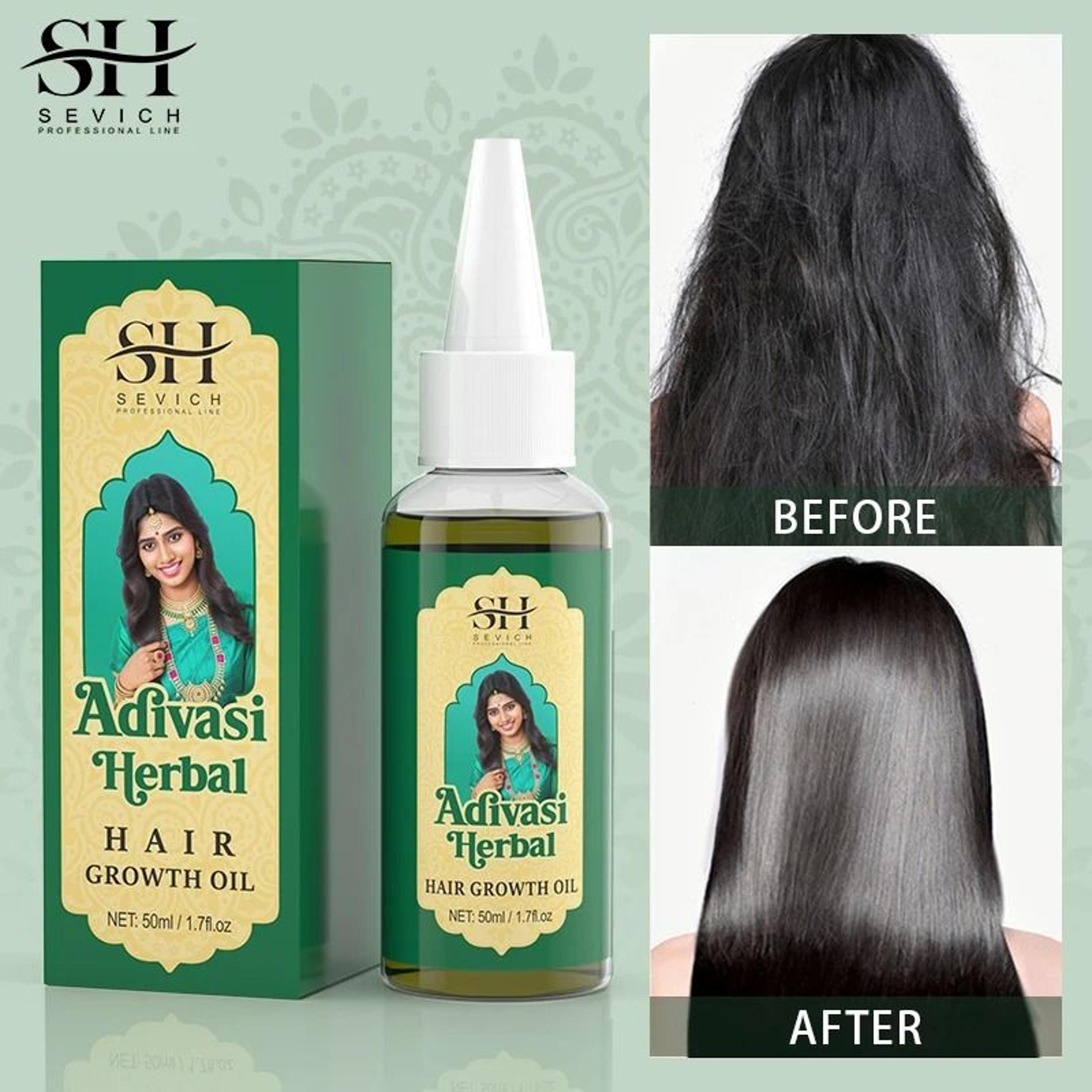 Adivasi Herbal Hair Growth Oil  Ayurvedic Anti Hair Loss Treatment For Stronger Thicker Hair 2