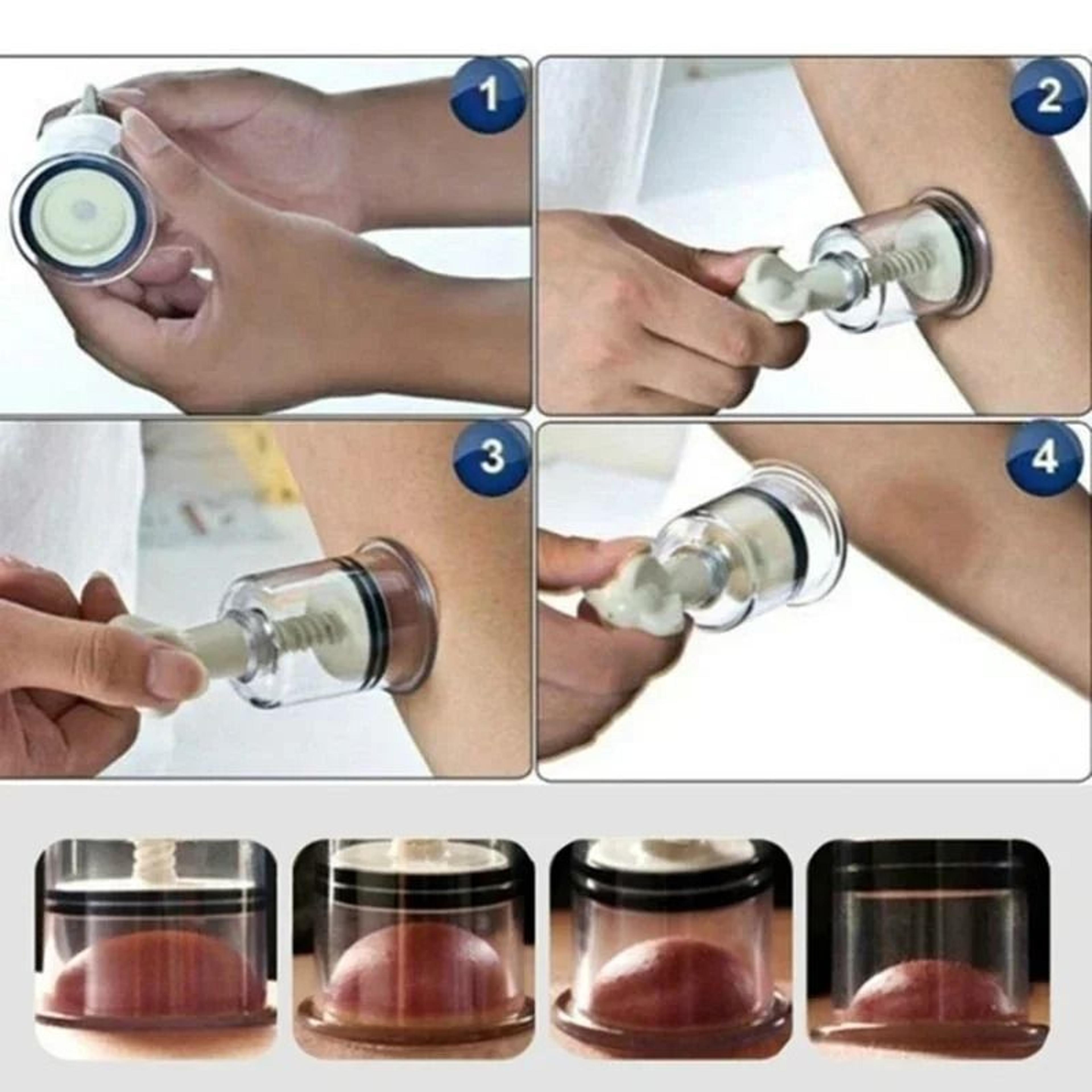 Vacuum Suction Massage Cupping Cup For Circulation And Relaxation 2