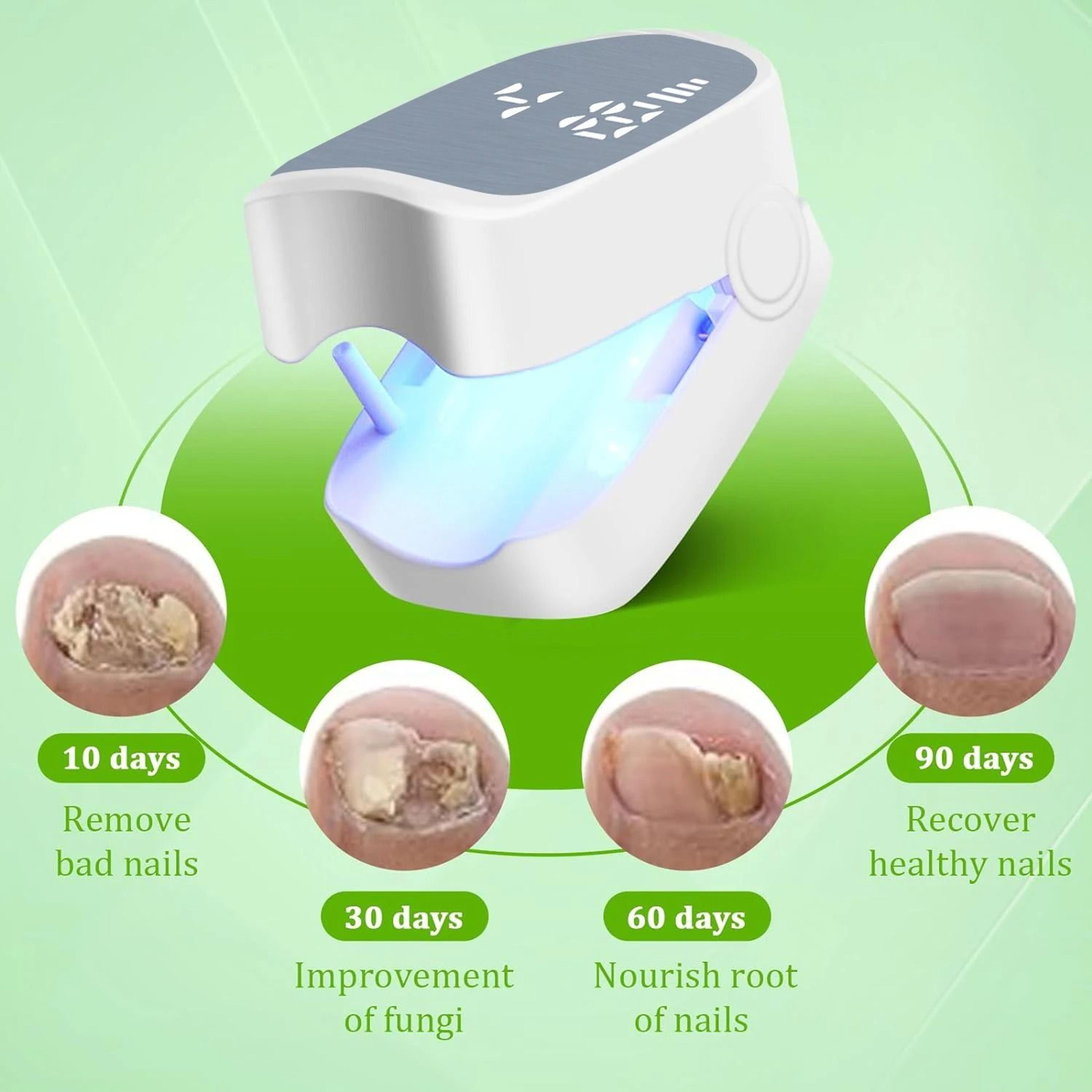 LED Laser Nail Fungus Treatment Device With Infrared And Blue Light Therapy 3