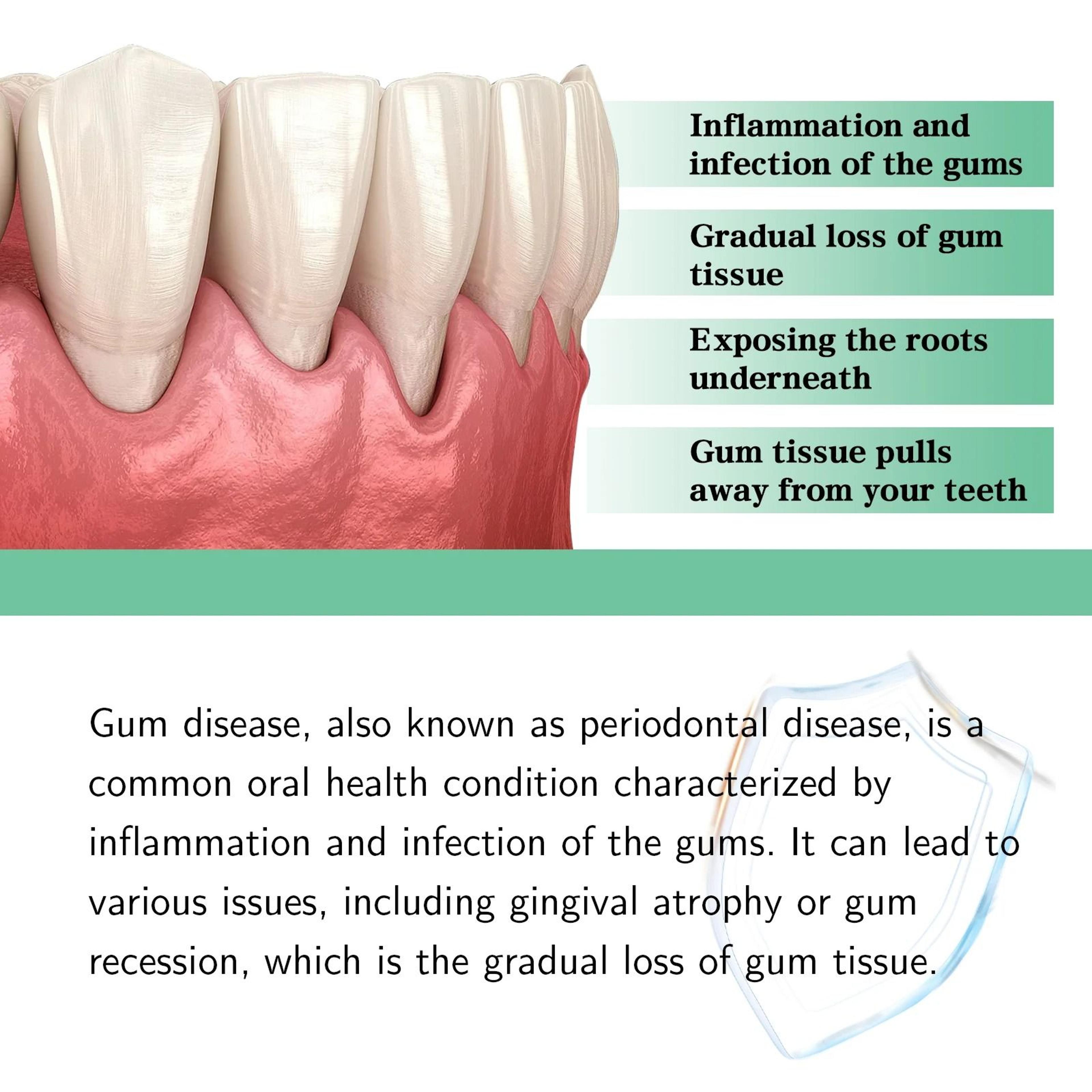 Gum Care Repair Drops For Daily Oral Hygiene 5