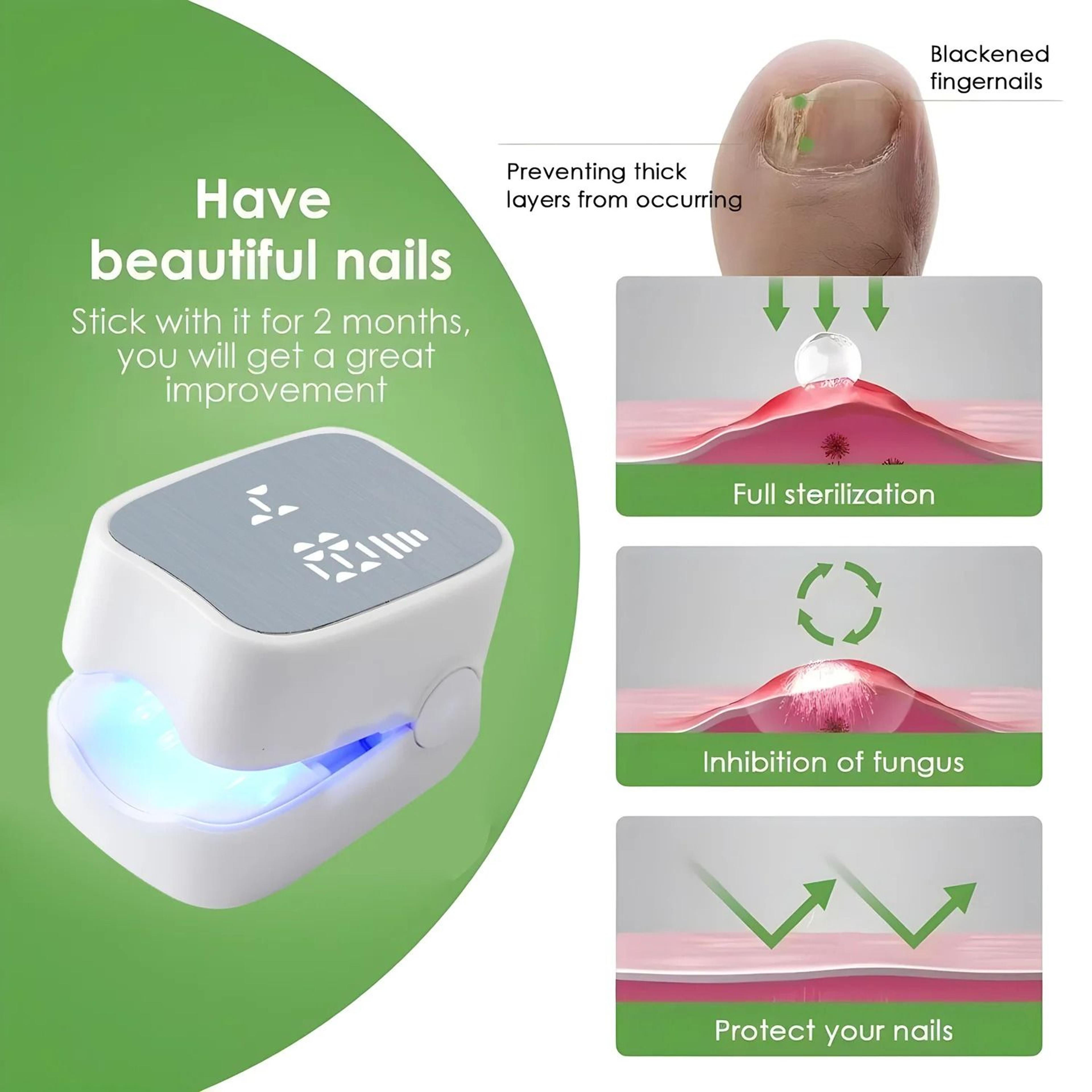 Nail Care Laser Device For Improving Nail Appearance And Smoothness 3