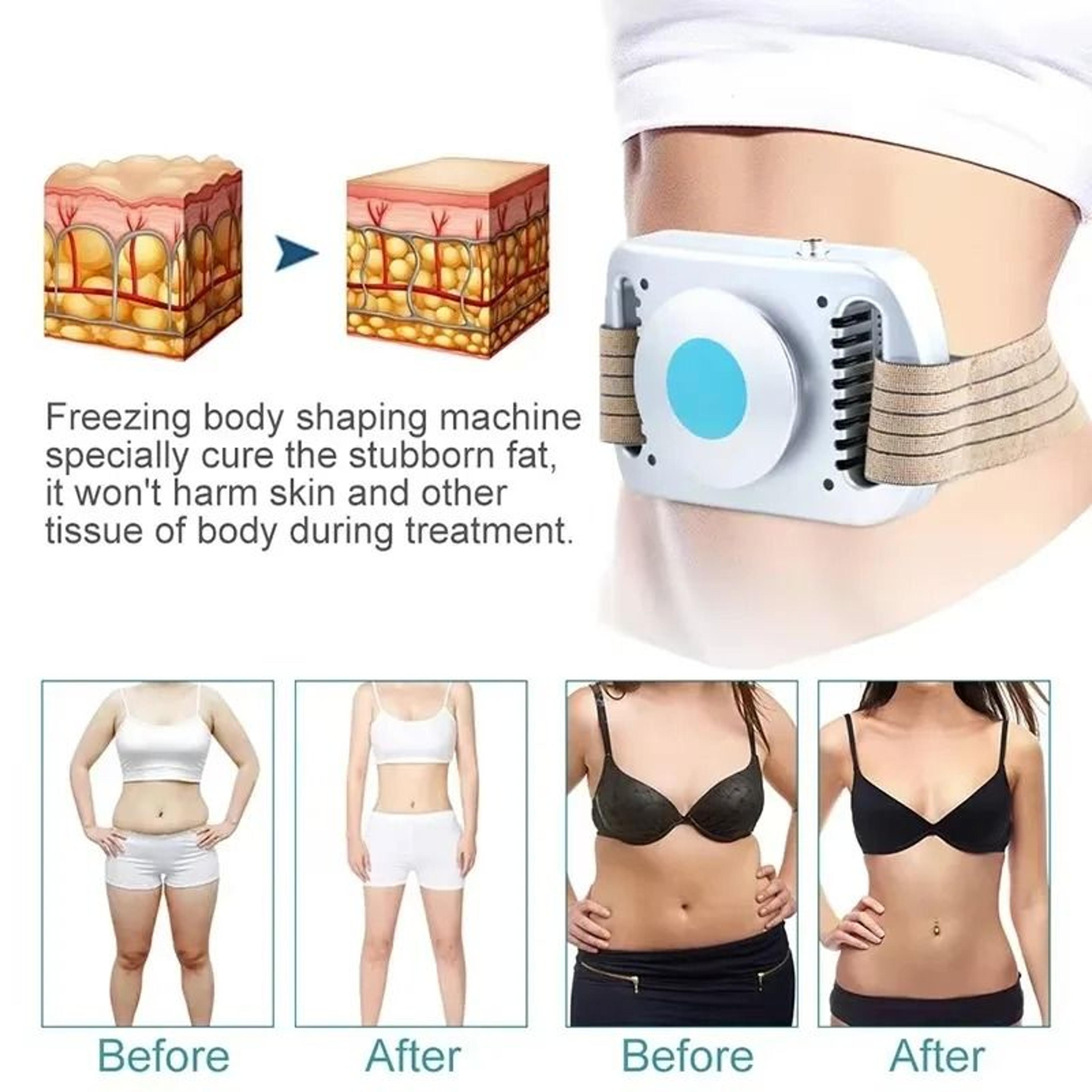 Fat Freeze Body Slimming Machine  Cryo AntiCellulite Cold Massager 3
