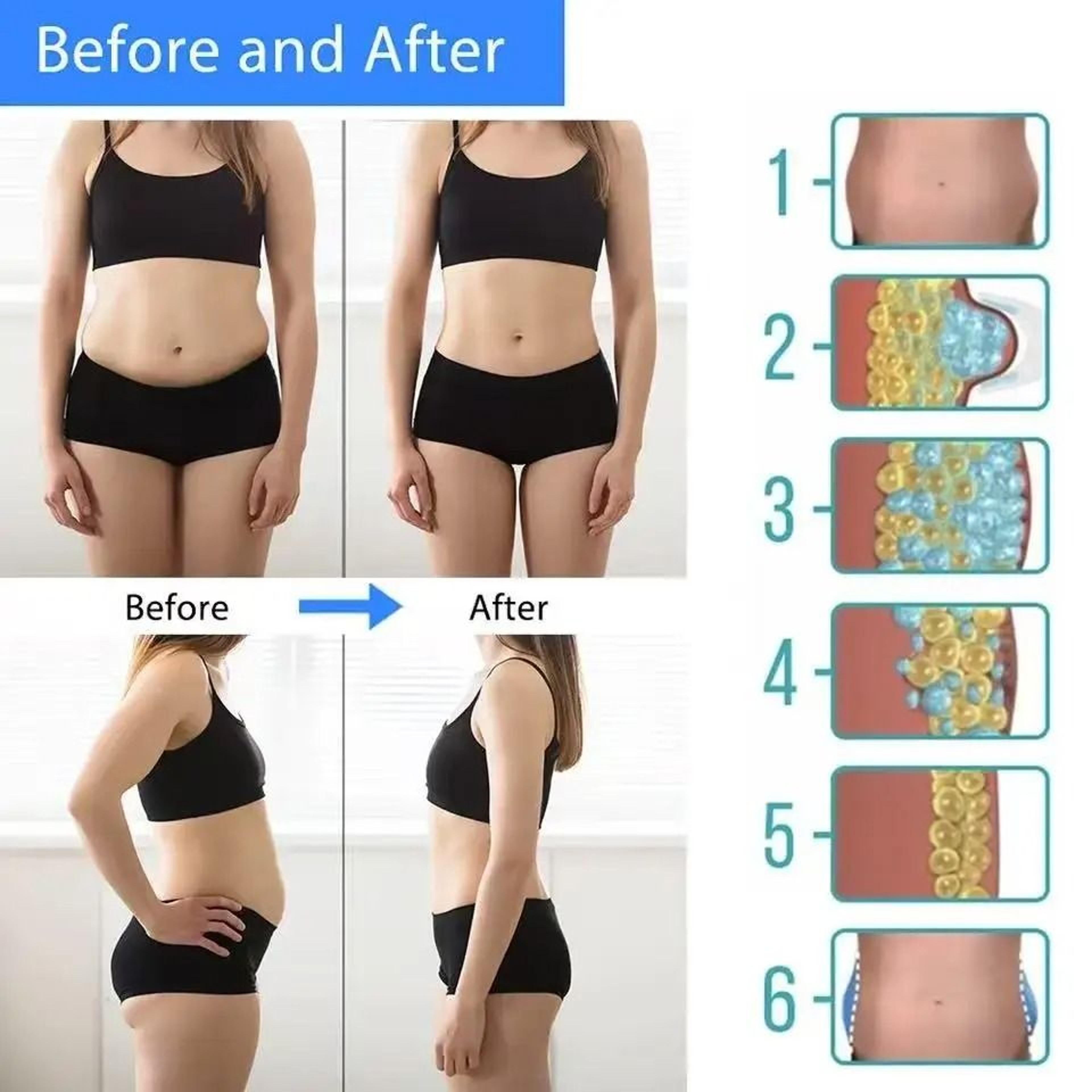Cryotherapy Lipo Freeze Machine  Advanced Fat Dissolve  Body Slimming 3