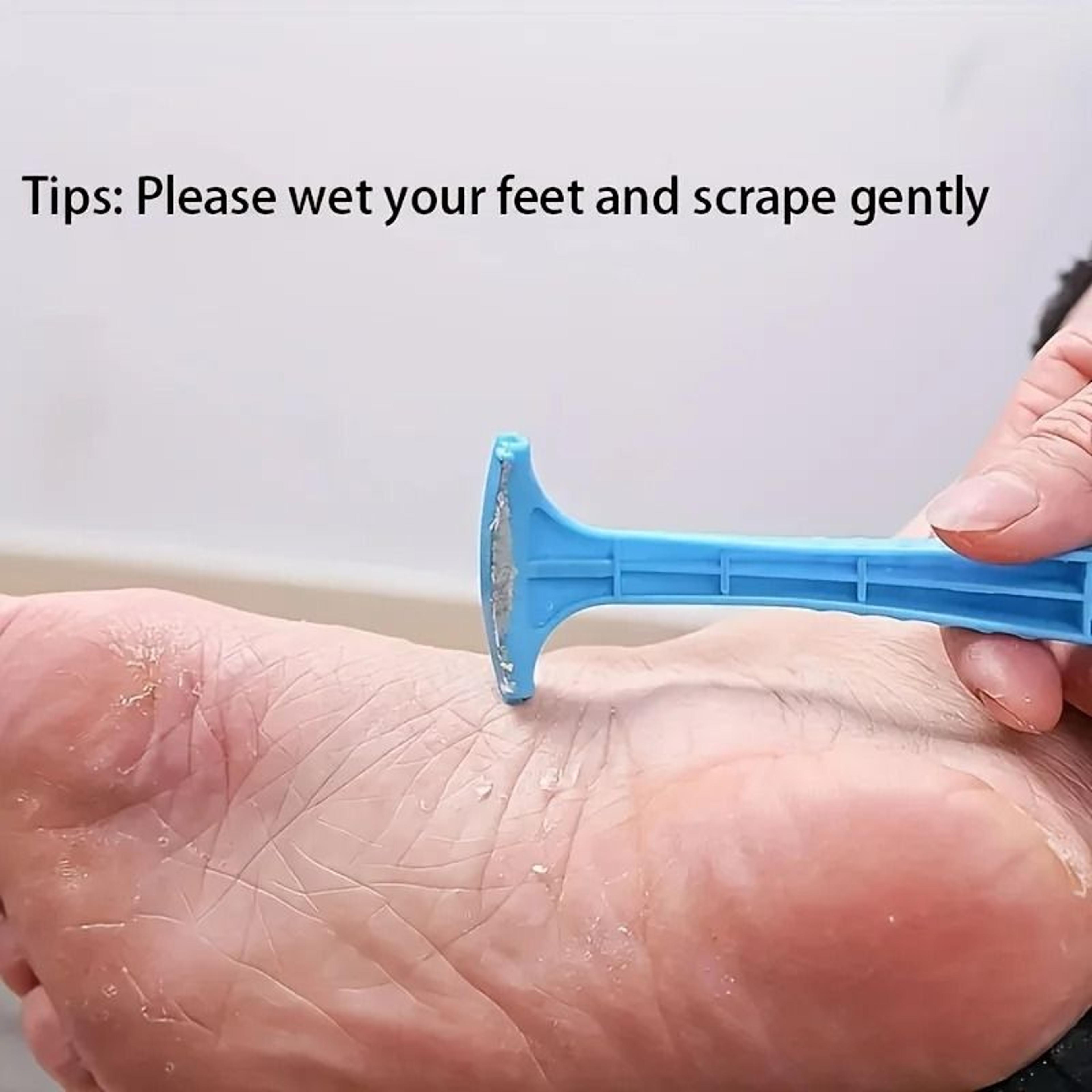 Pedicure Foot File Set  Callus Removal Tool For Smooth Feet 1