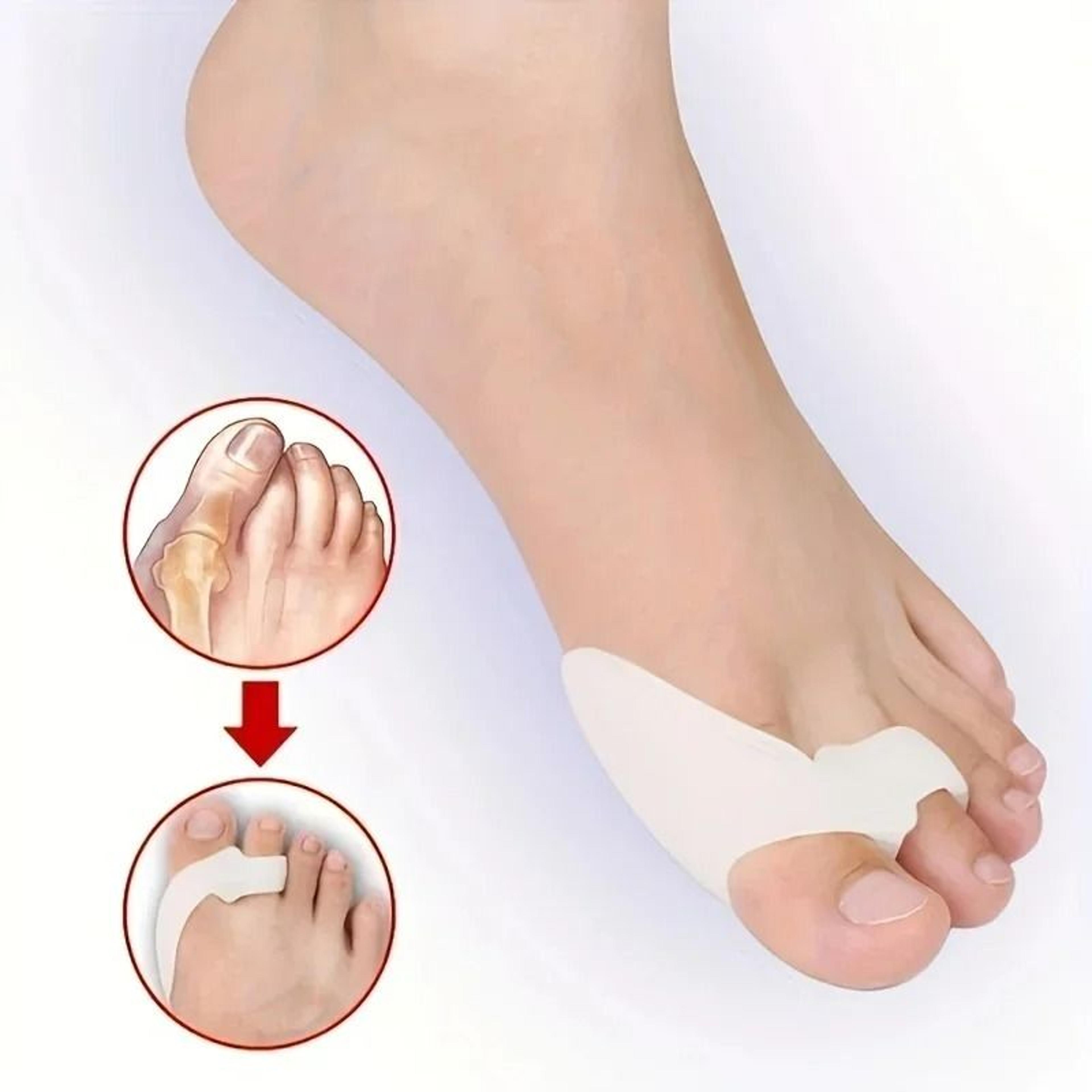 1 Pair Silicone Toe Corrector  Instant Hallux Valgus Relief  Foot Comfort 0