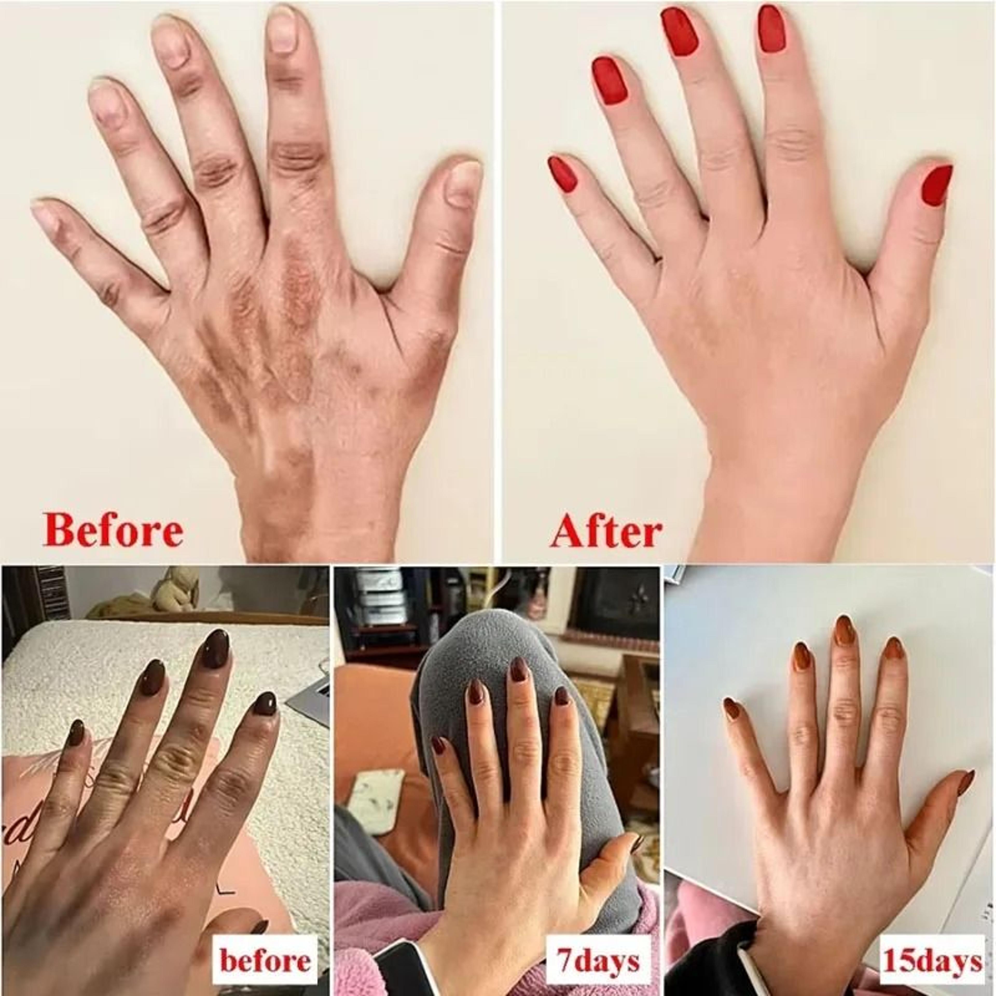 AntiWrinkle Coconut Oil Hand Cream  Intensive AntiCrack  Repair Serum 1