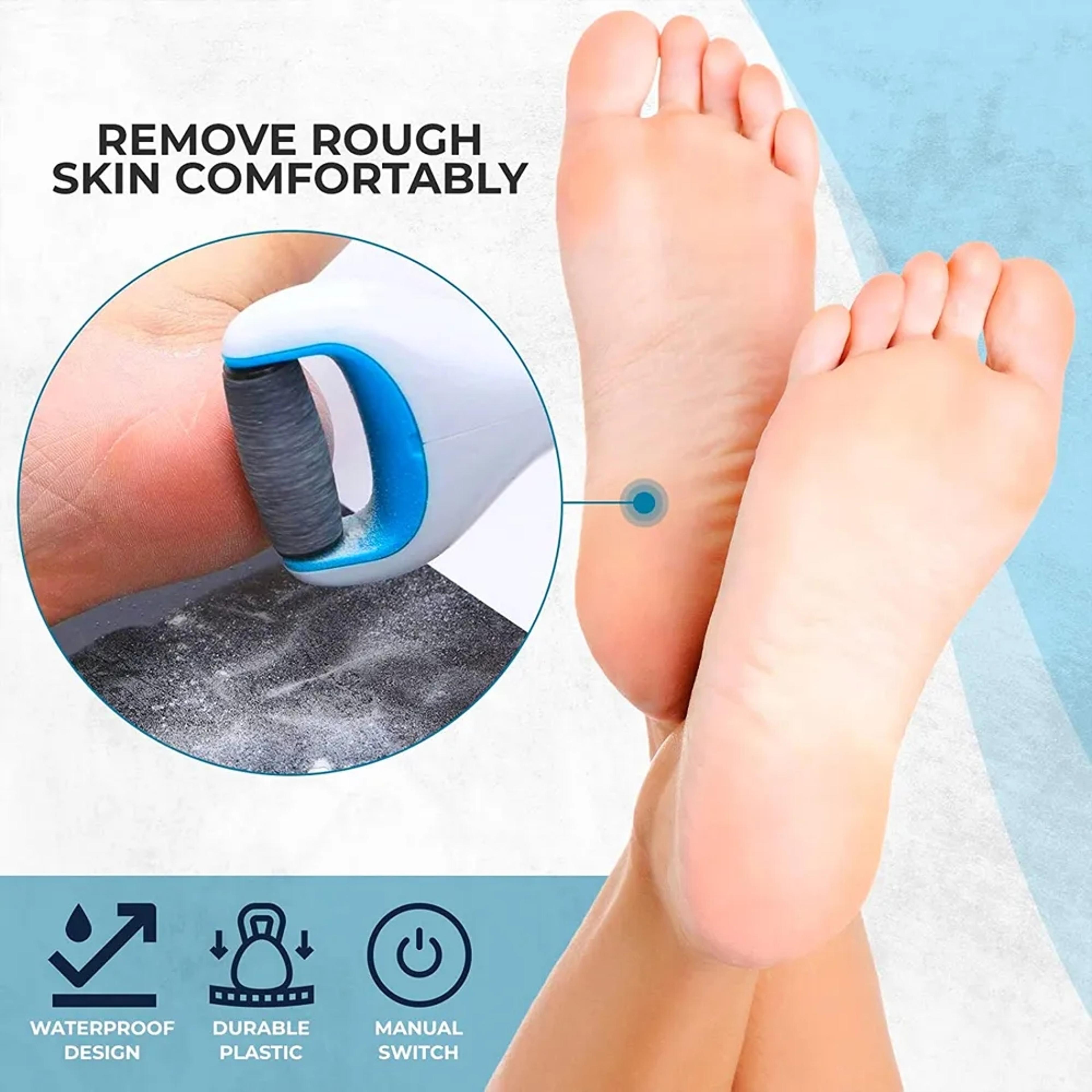 Rechargeable Electric Foot File  Smooth Heels  Remove Dead Skin Fast 1