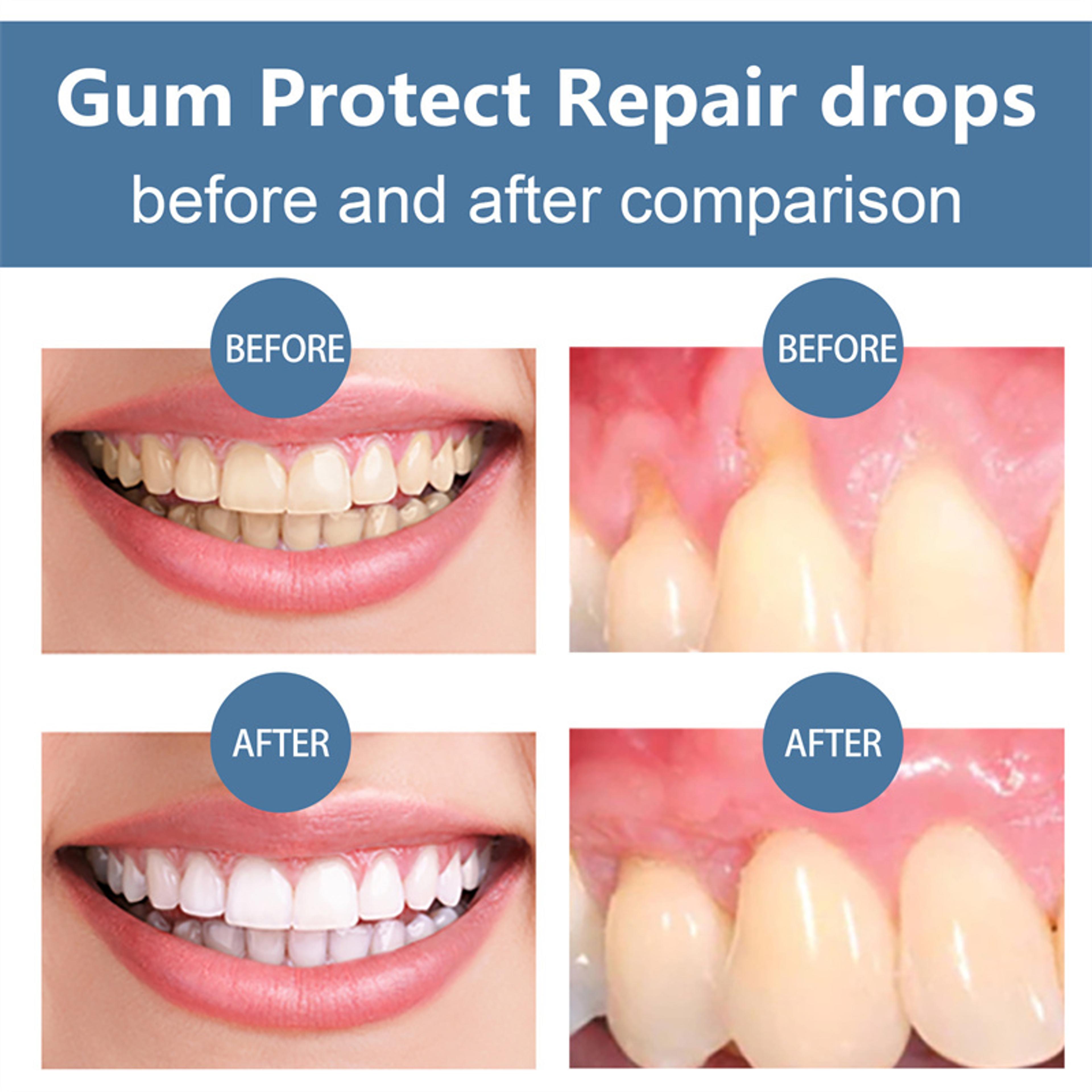 FastActing Gum Repair Serum  Soothes Sensitive Teeth  Helps Restore Damaged Gums 7