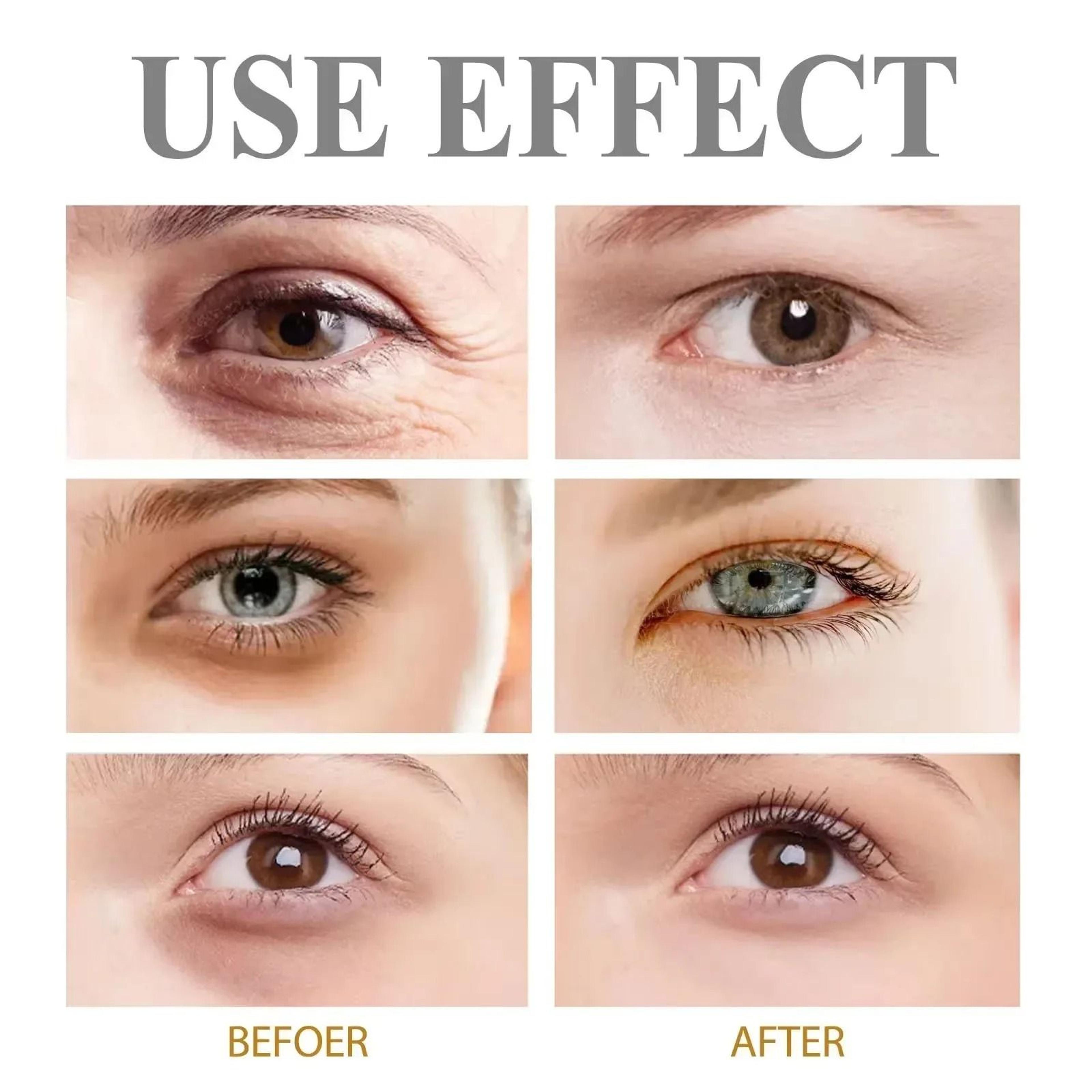 Intensive Eye Rescue Cream  Advanced Dark Circle  Puffiness Correction 2